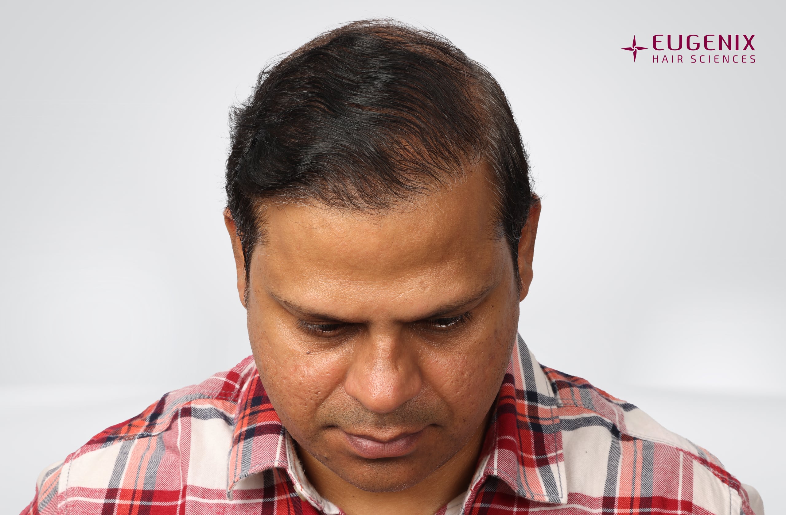 Rakesh Singh Rathore After Head Down copy