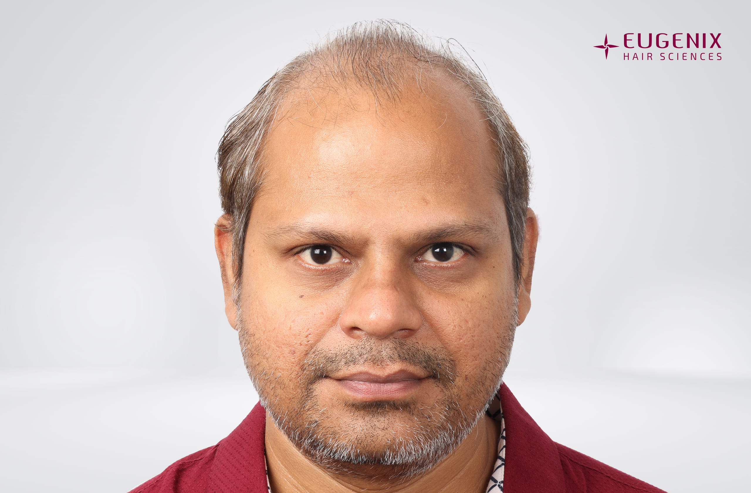 Rakesh Singh Rathore Before Front copy