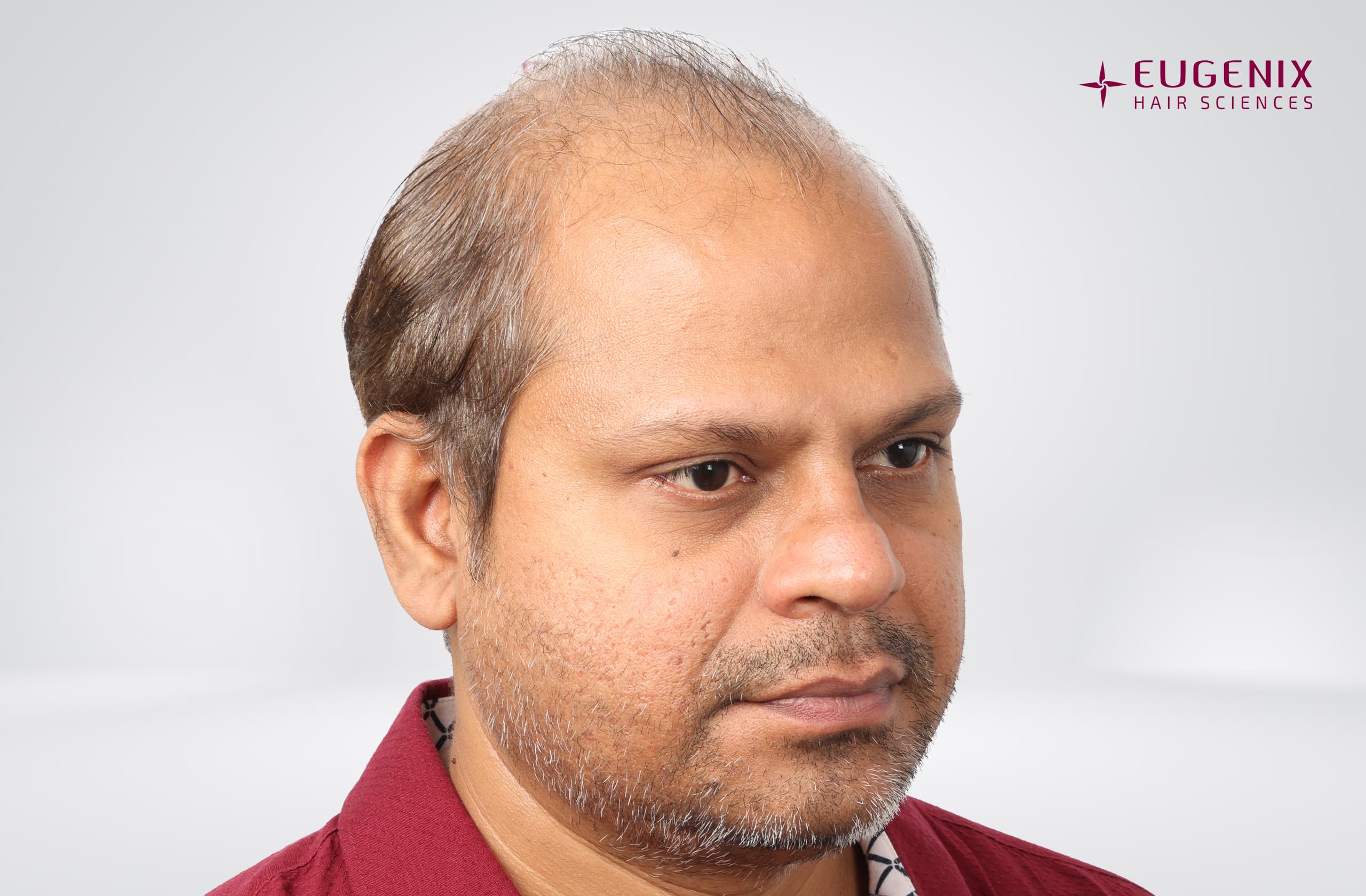 Rakesh Singh Rathore Before Left copy