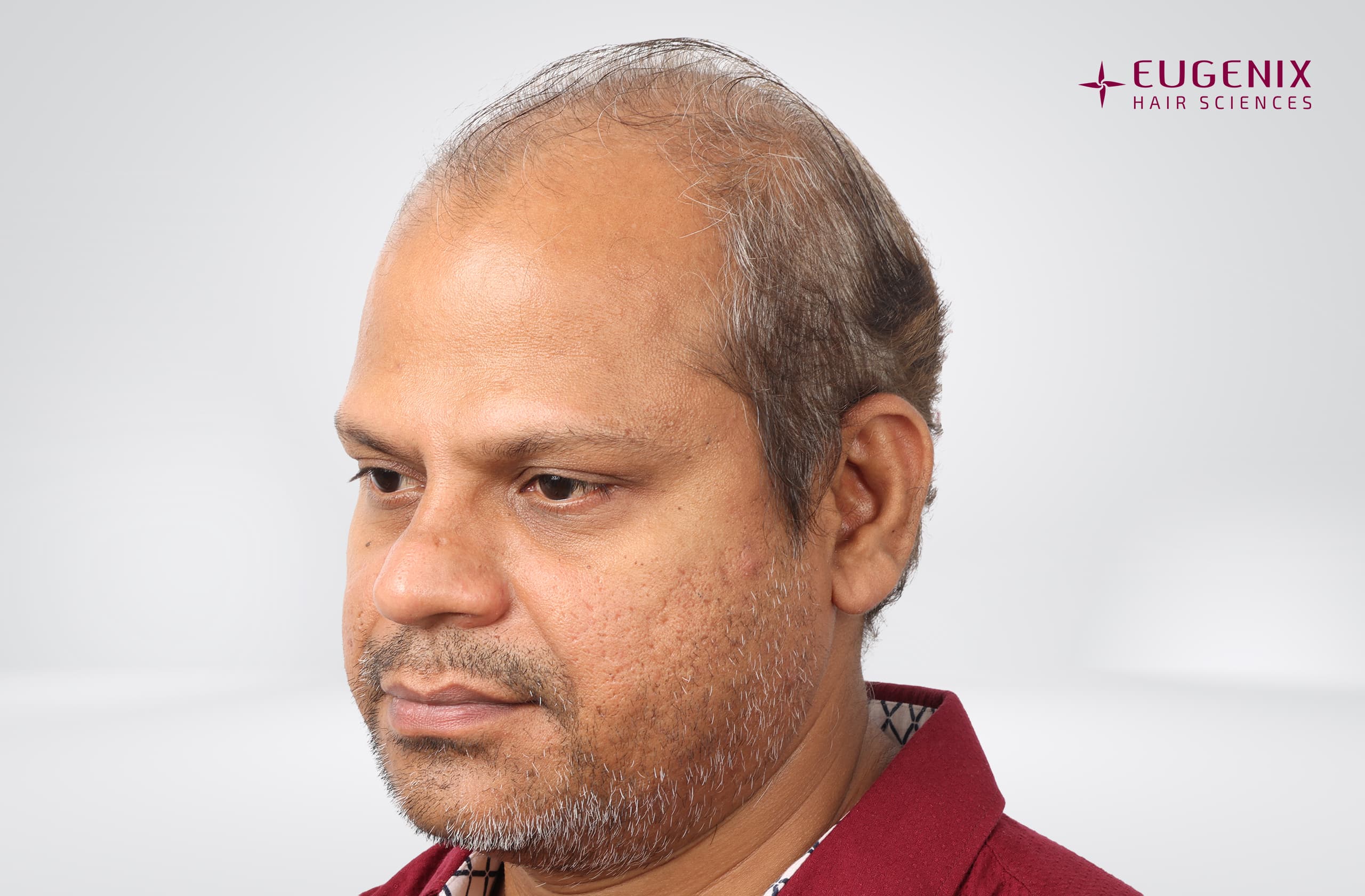 Rakesh Singh Rathore Before Right copy