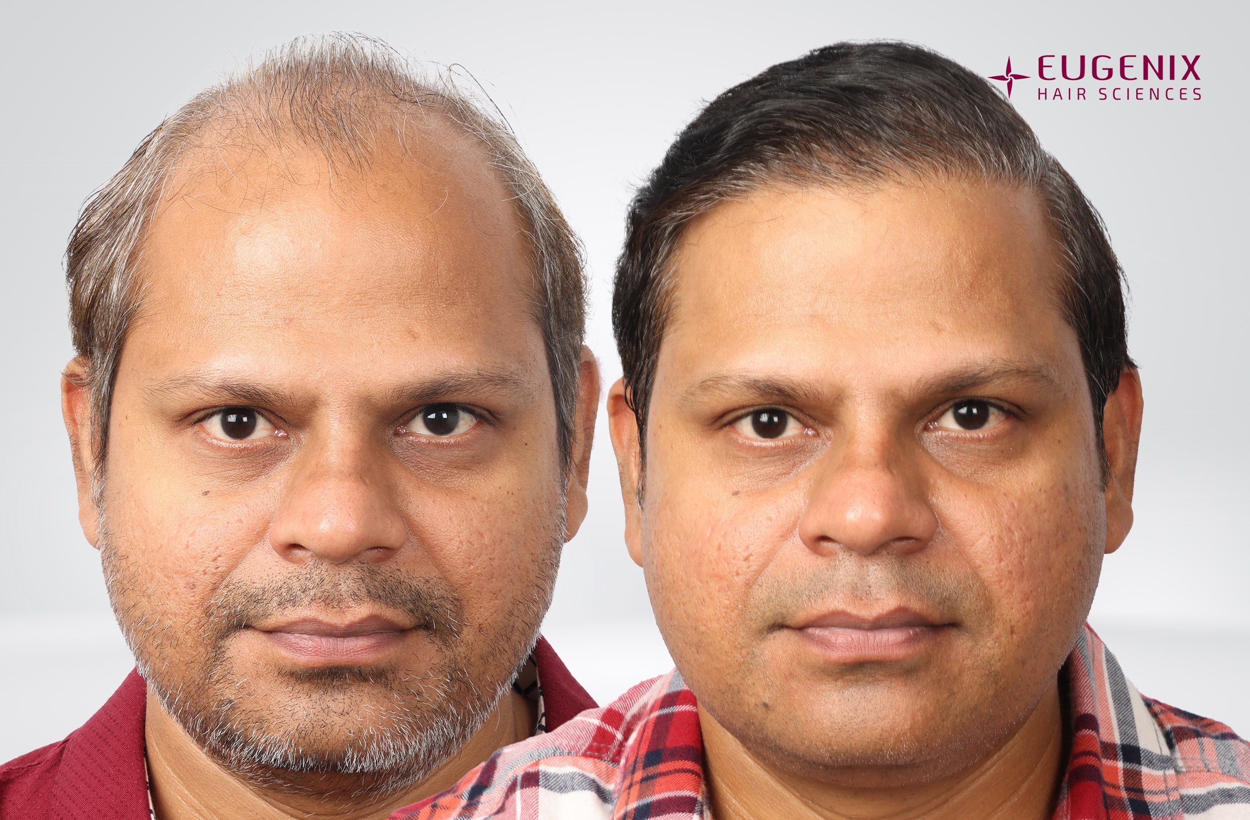 Rakesh Singh Rathore Before and After Front copy