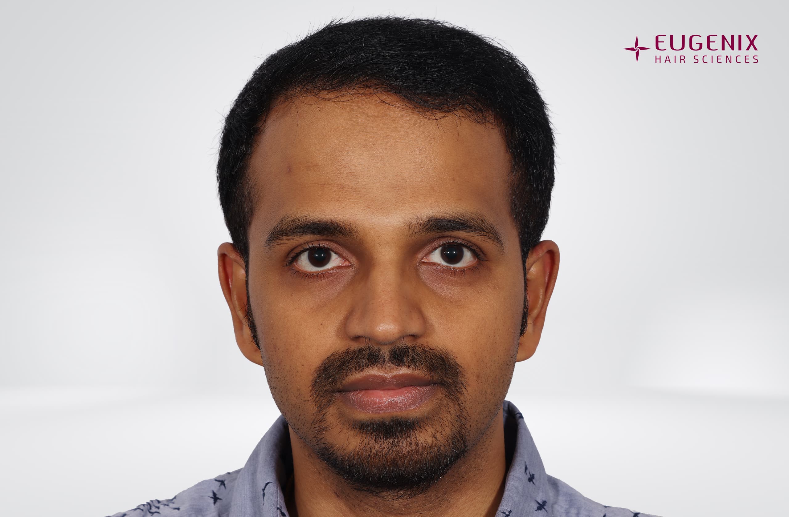 Sanket Sanjay Achari After Front copy