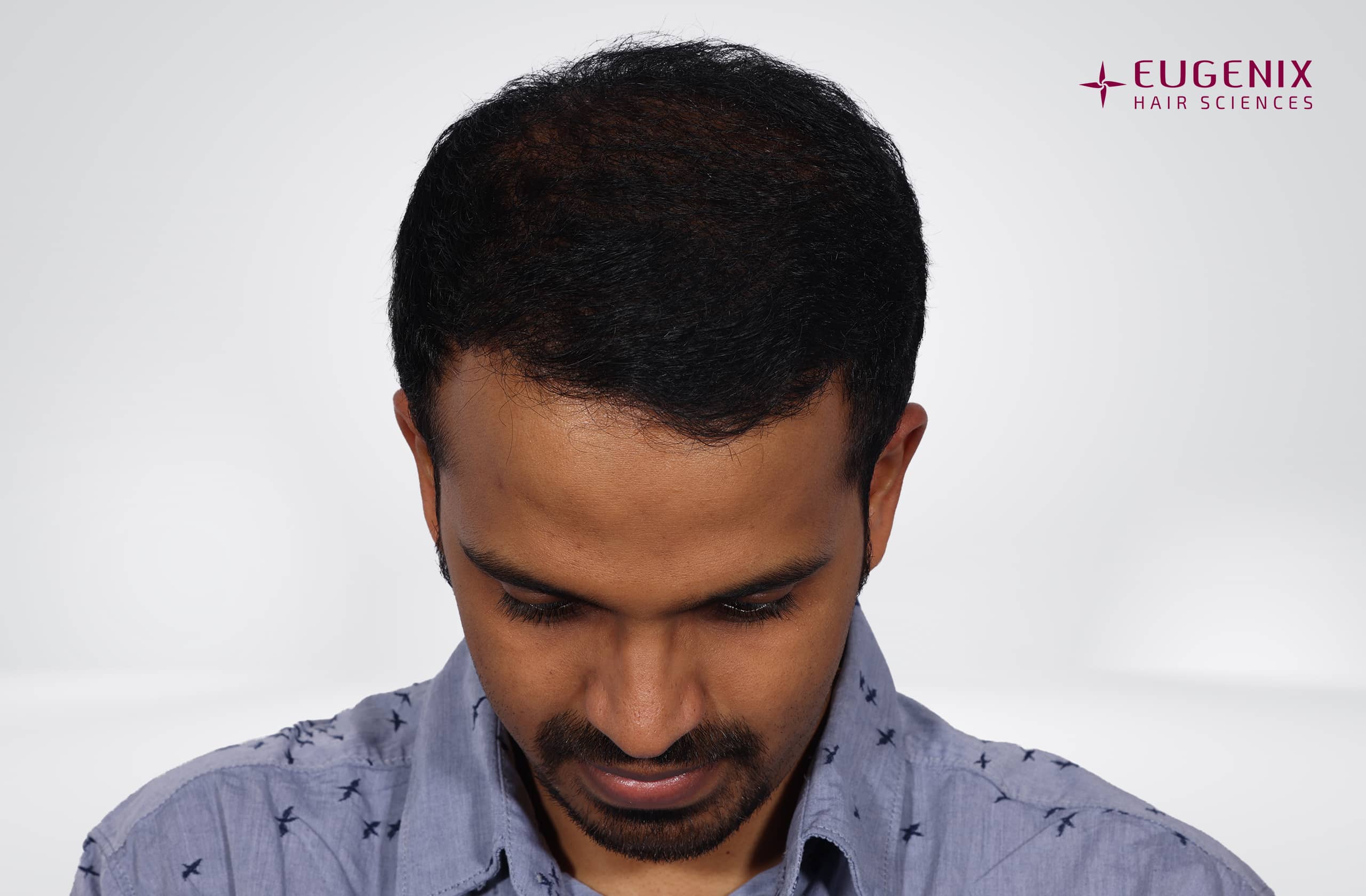 Sanket Sanjay Achari After Head Down copy
