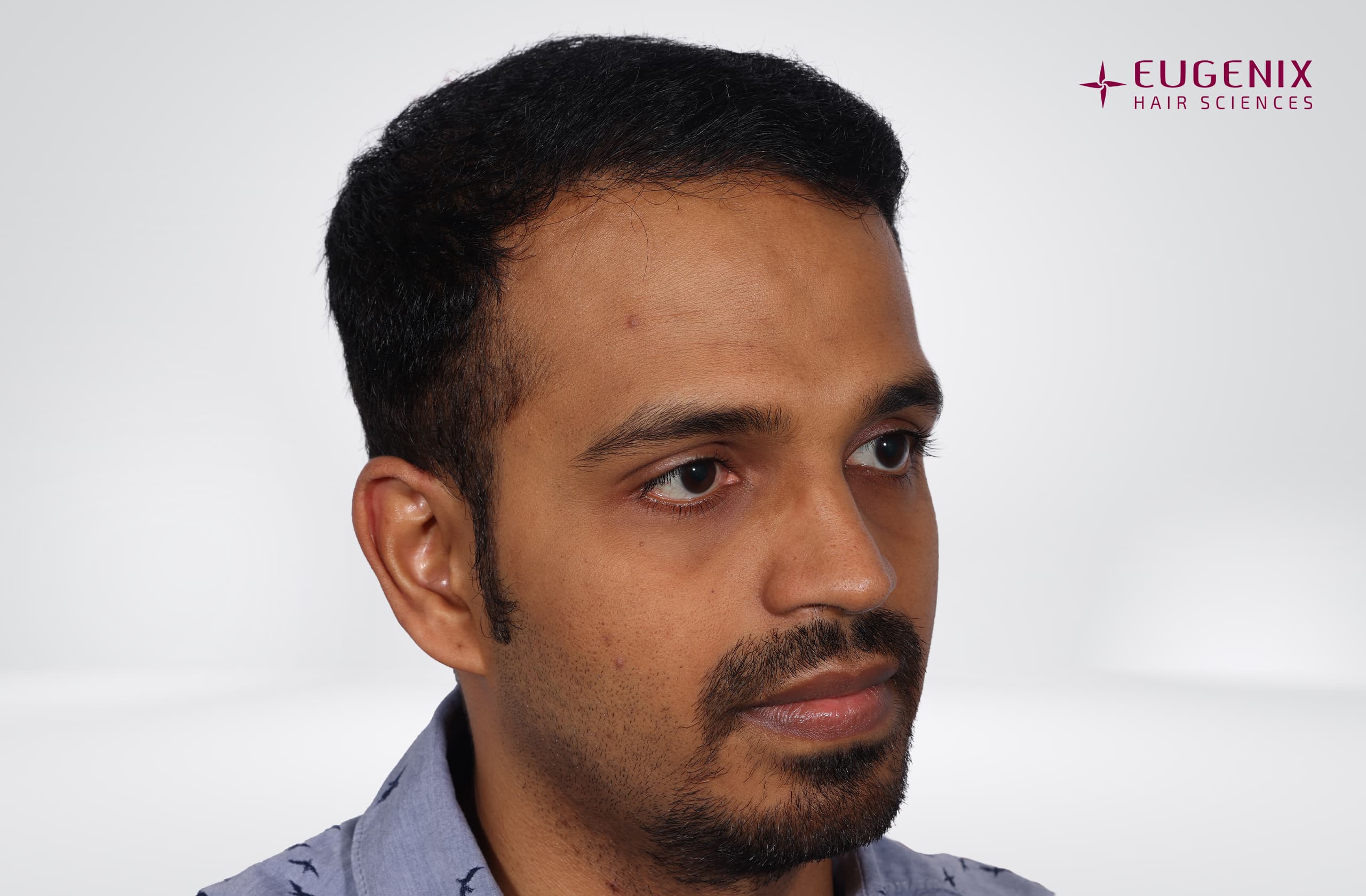 Sanket Sanjay Achari After Left copy