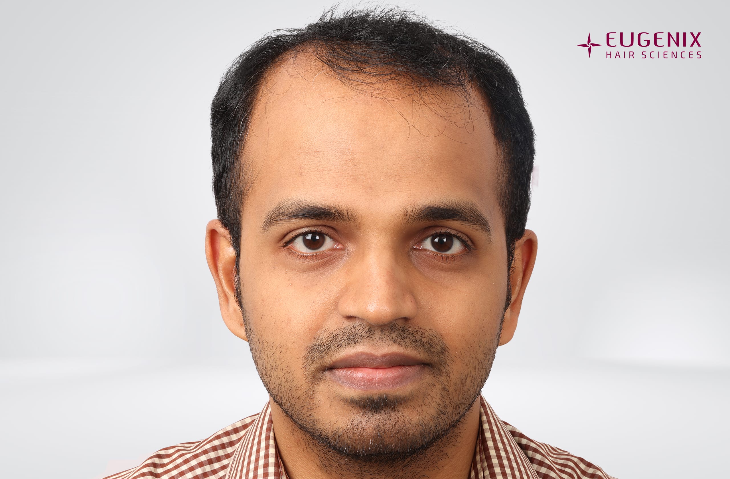 Sanket Sanjay Achari Before Front copy
