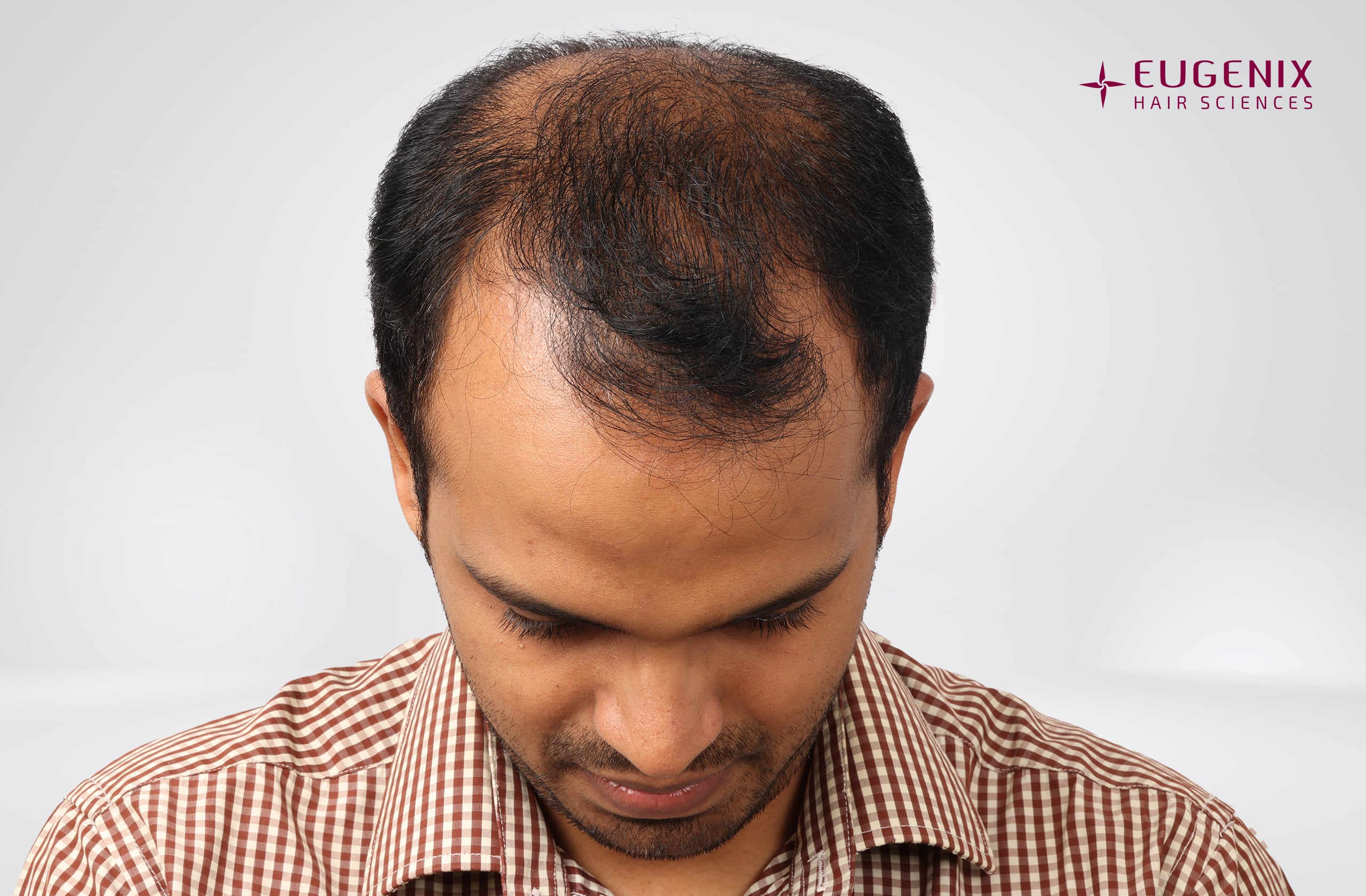 Sanket Sanjay Achari Before Head Down copy