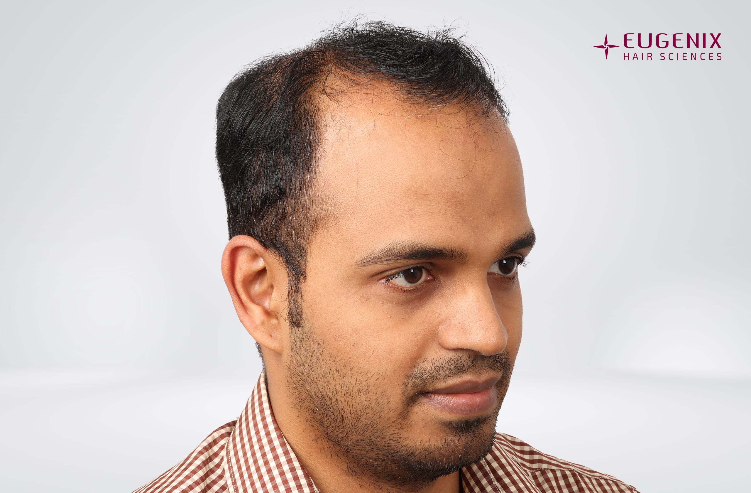 Sanket Sanjay Achari Before Left copy