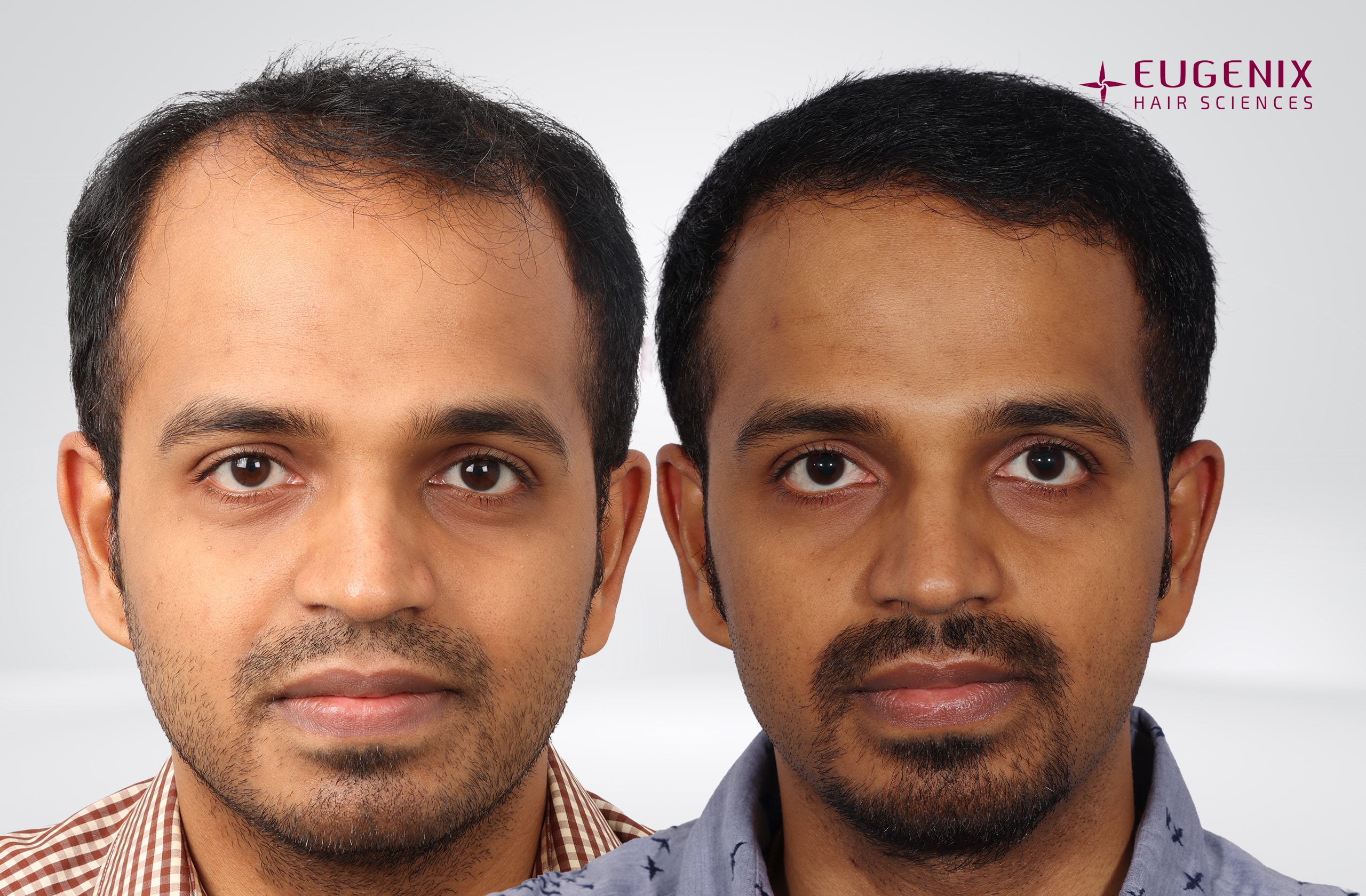 Sanket Sanjay Achari Before and After Front copy