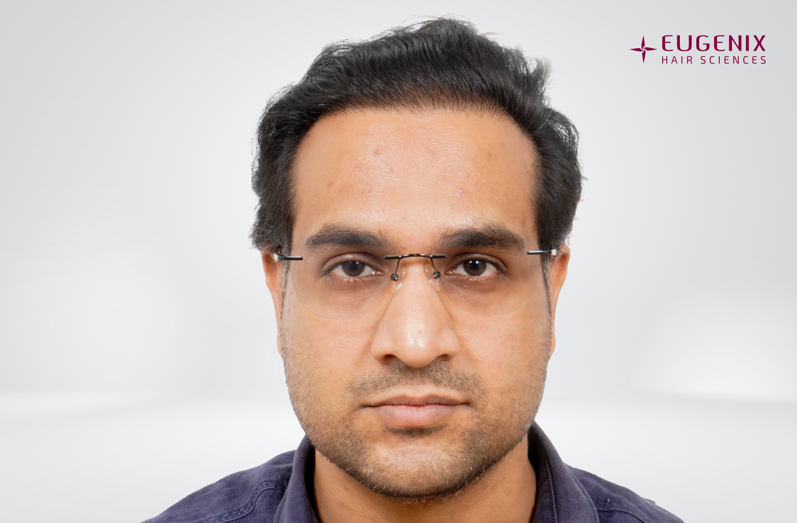 Saurabh Tiwari After Front copy
