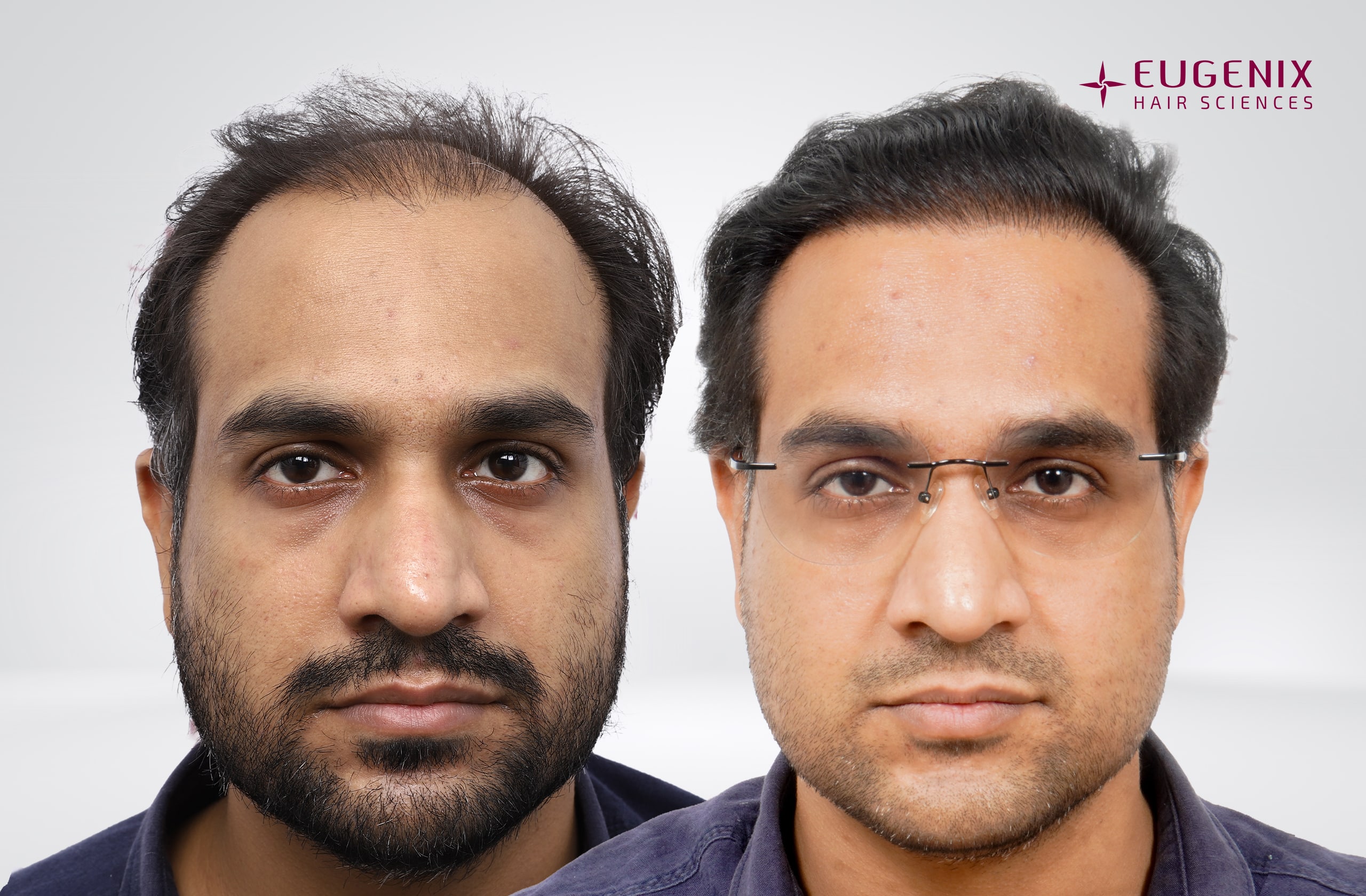 Saurabh Tiwari After and Before Front copy