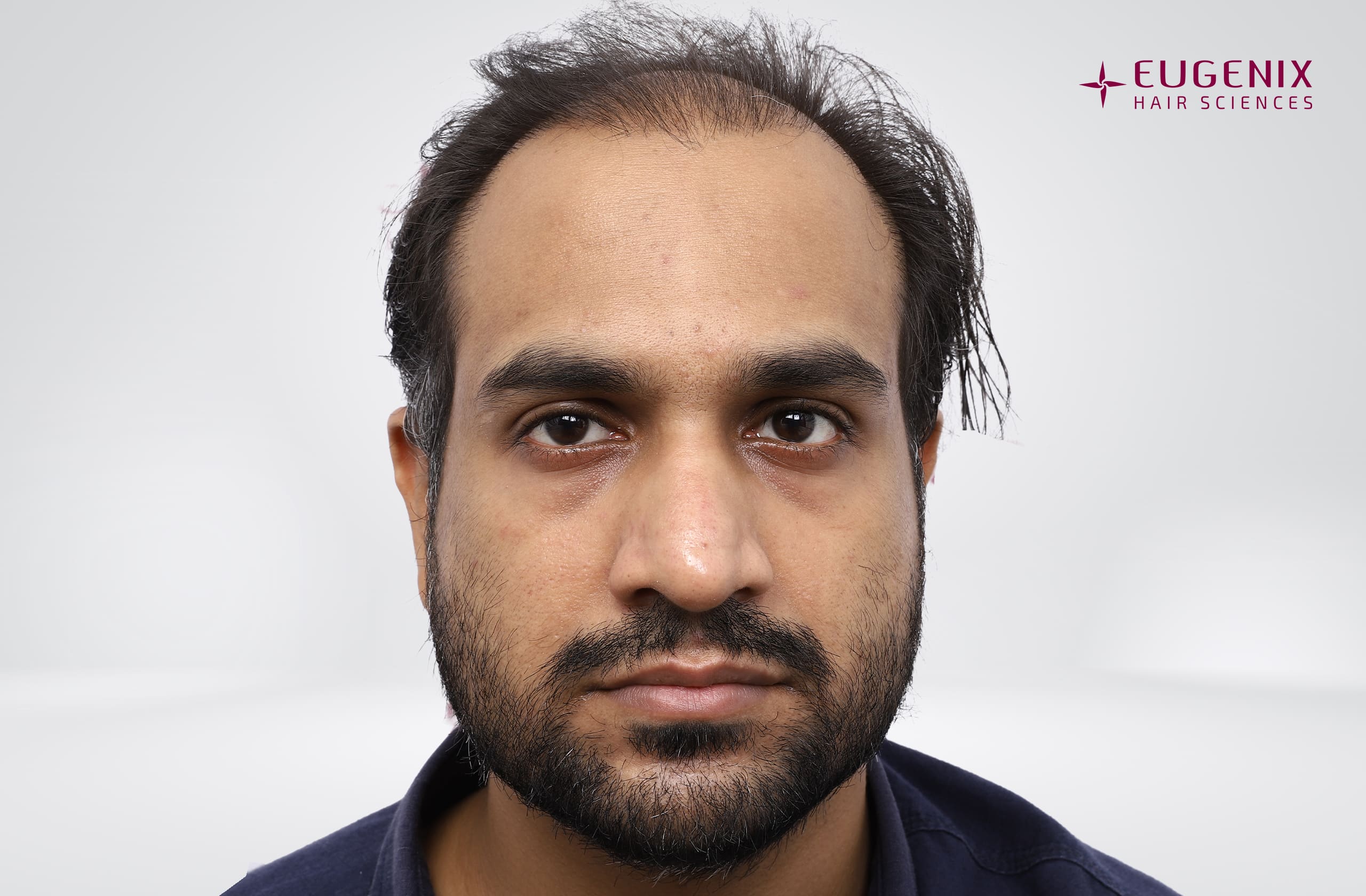Saurabh Tiwari Before Front copy