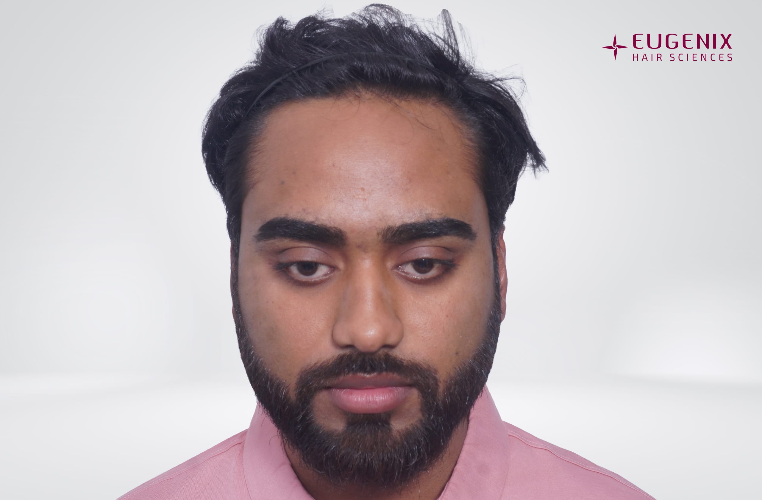 Soumyadeep Hazra After Before Front copy