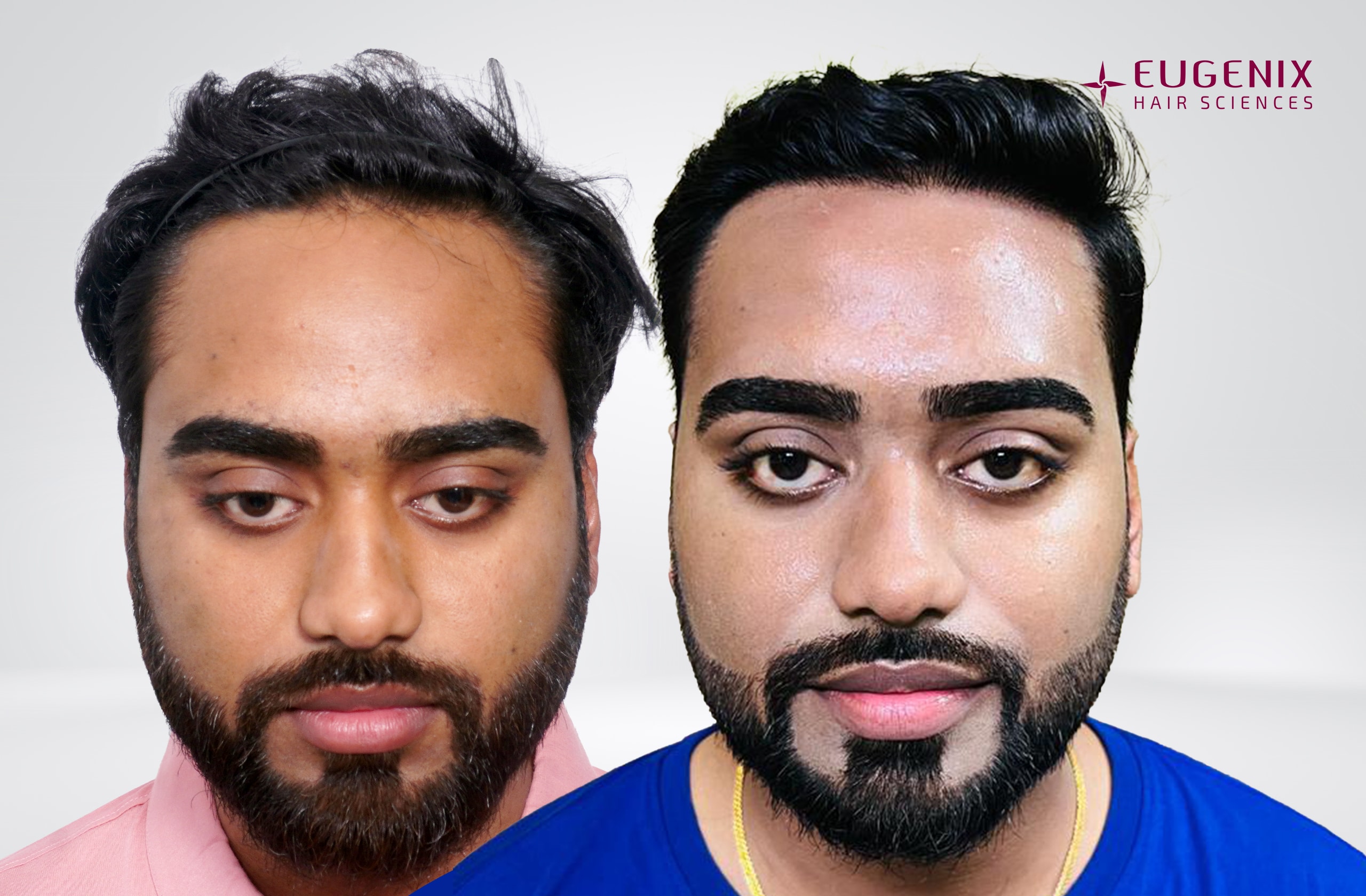 Soumyadeep Hazra After & Before Front copy