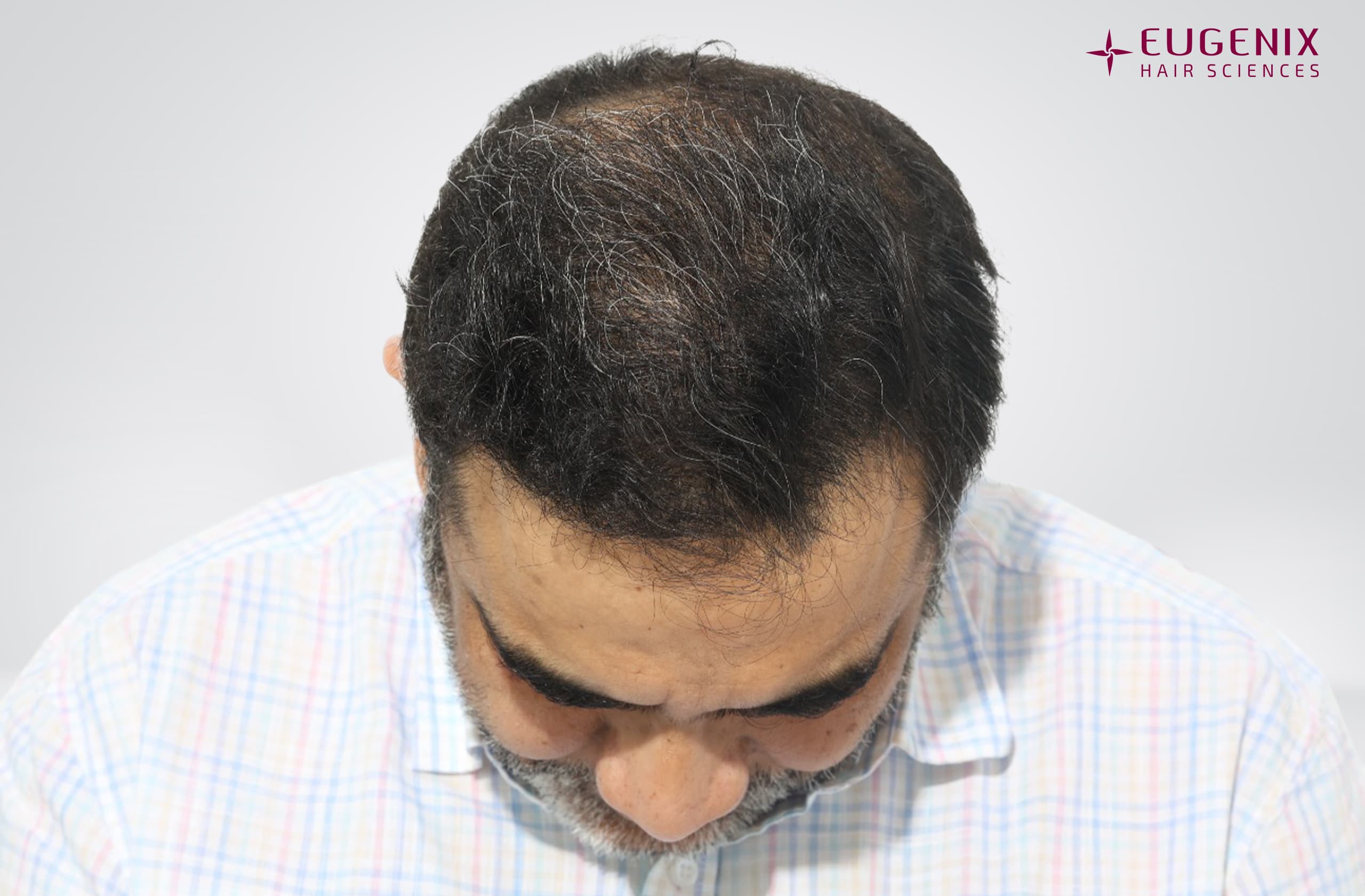 Vamshi Velma After Head Down copy