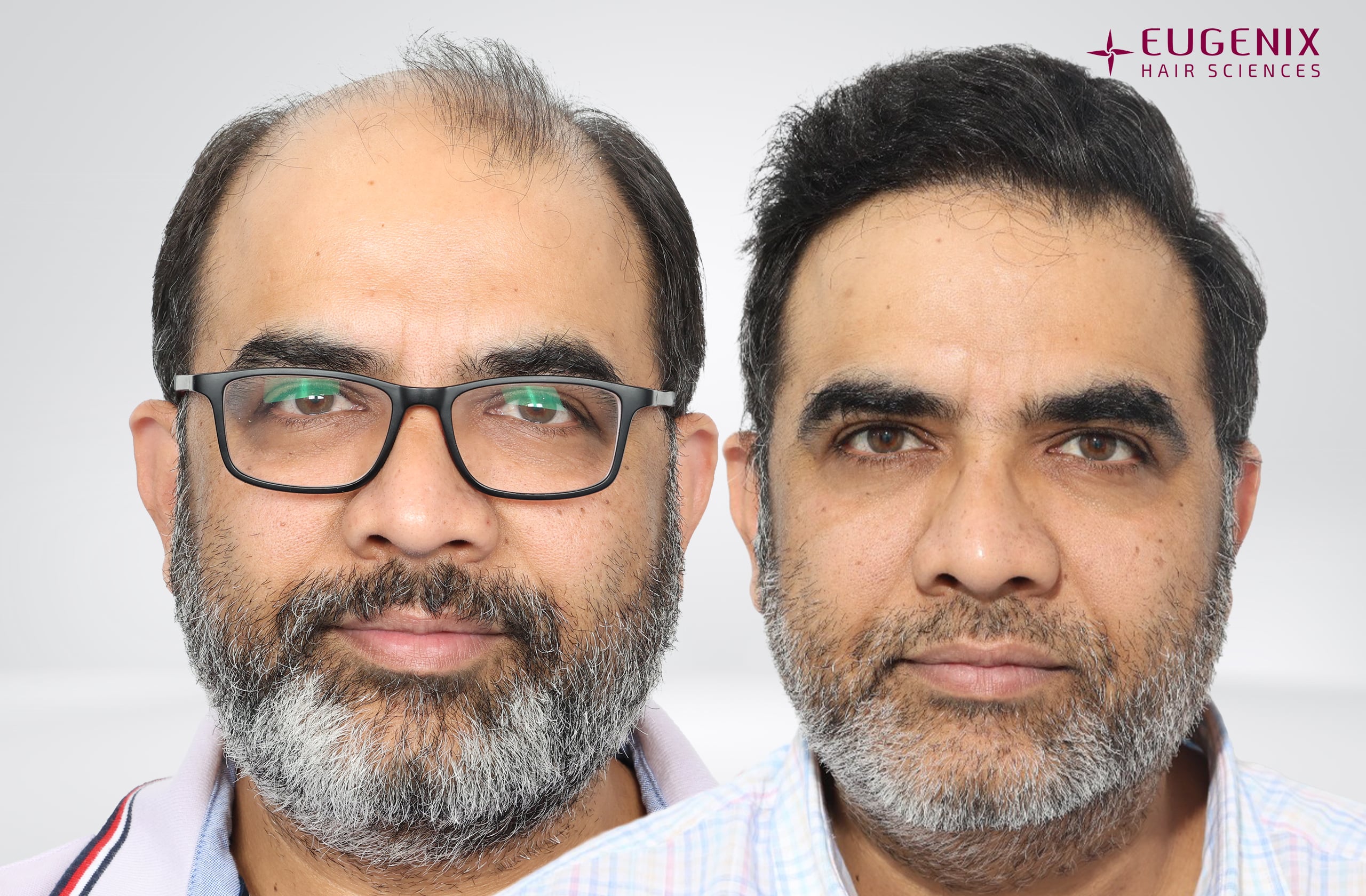 Vamshi Velma Before & After Front copy