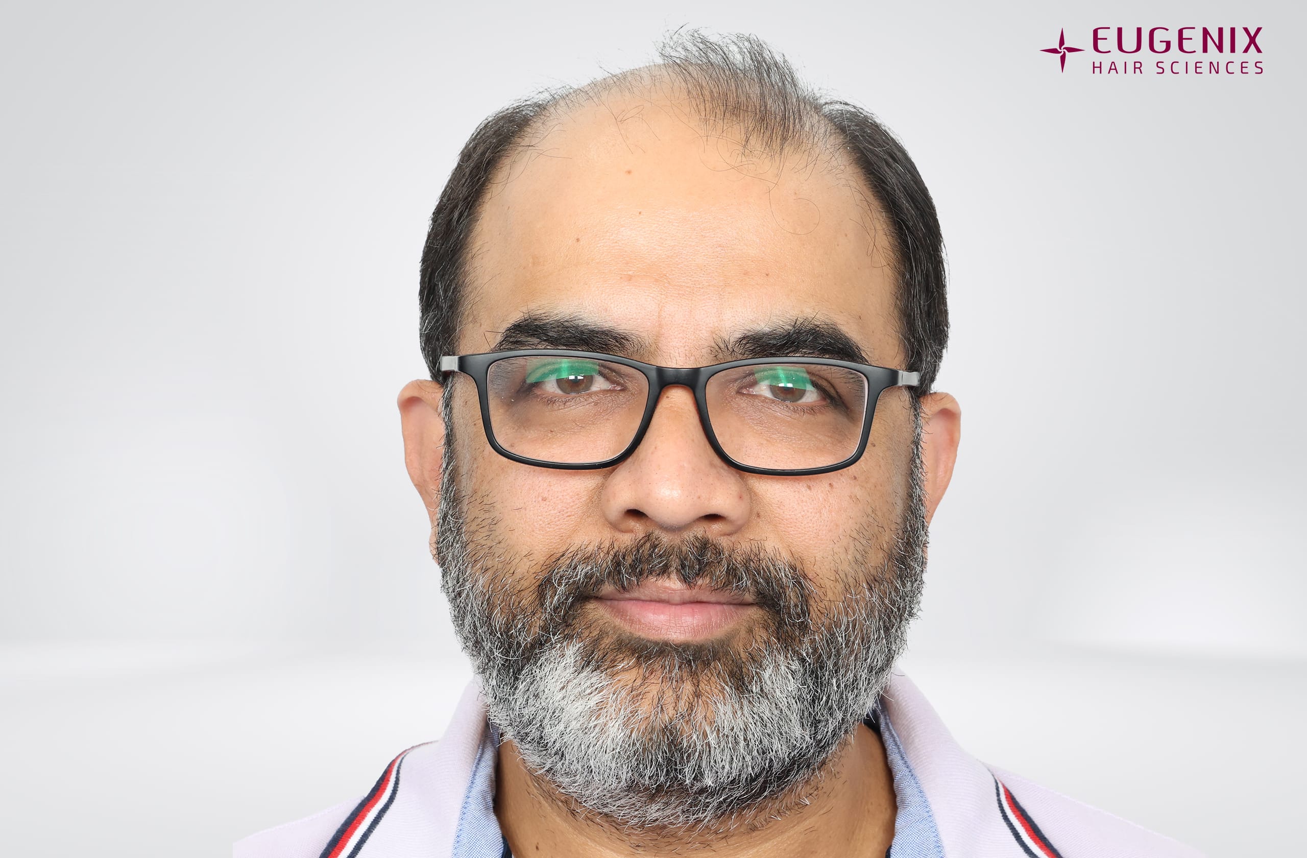 Vamshi Velma Before Front copy