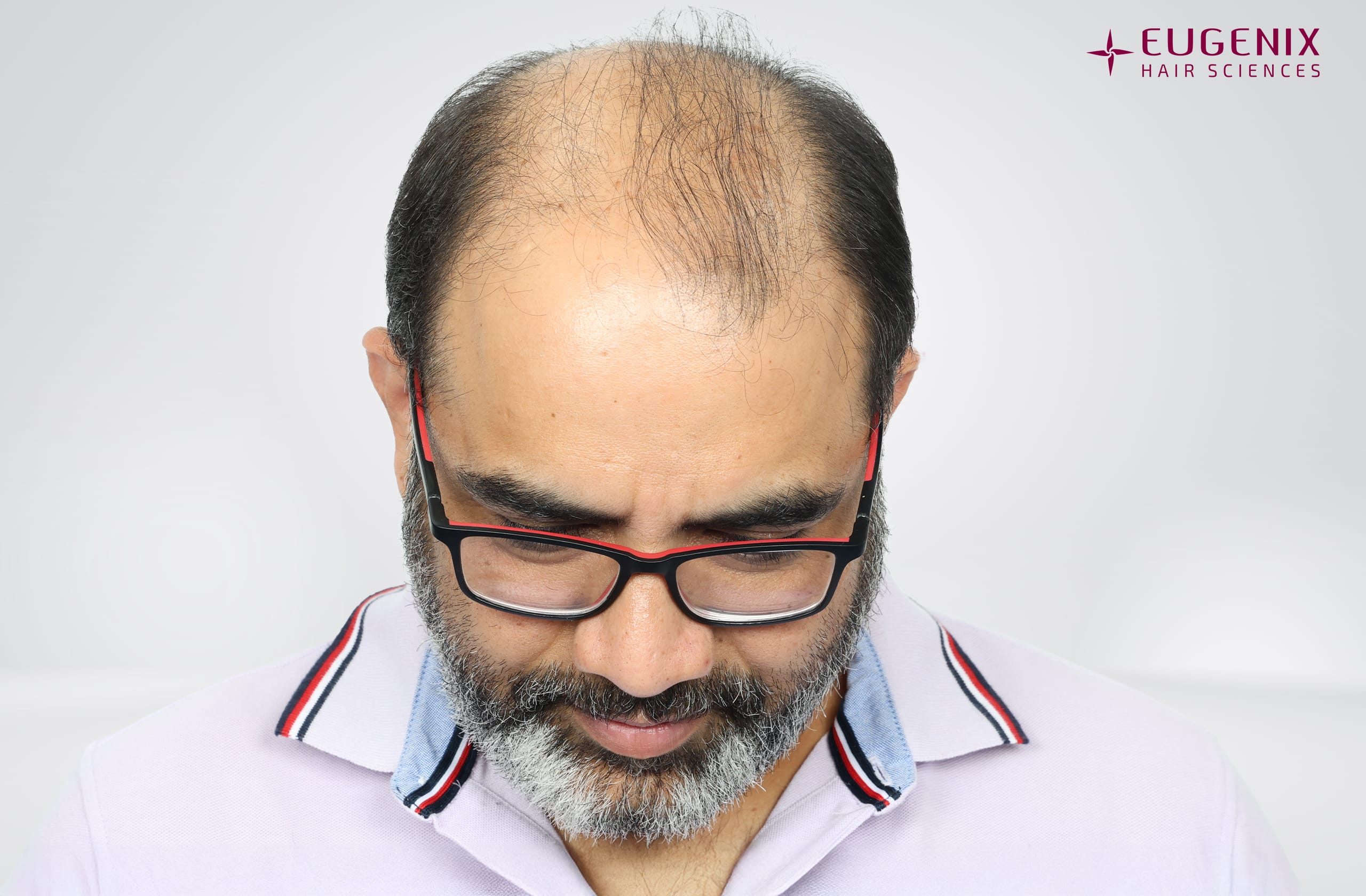 Vamshi Velma Before Head Down copy