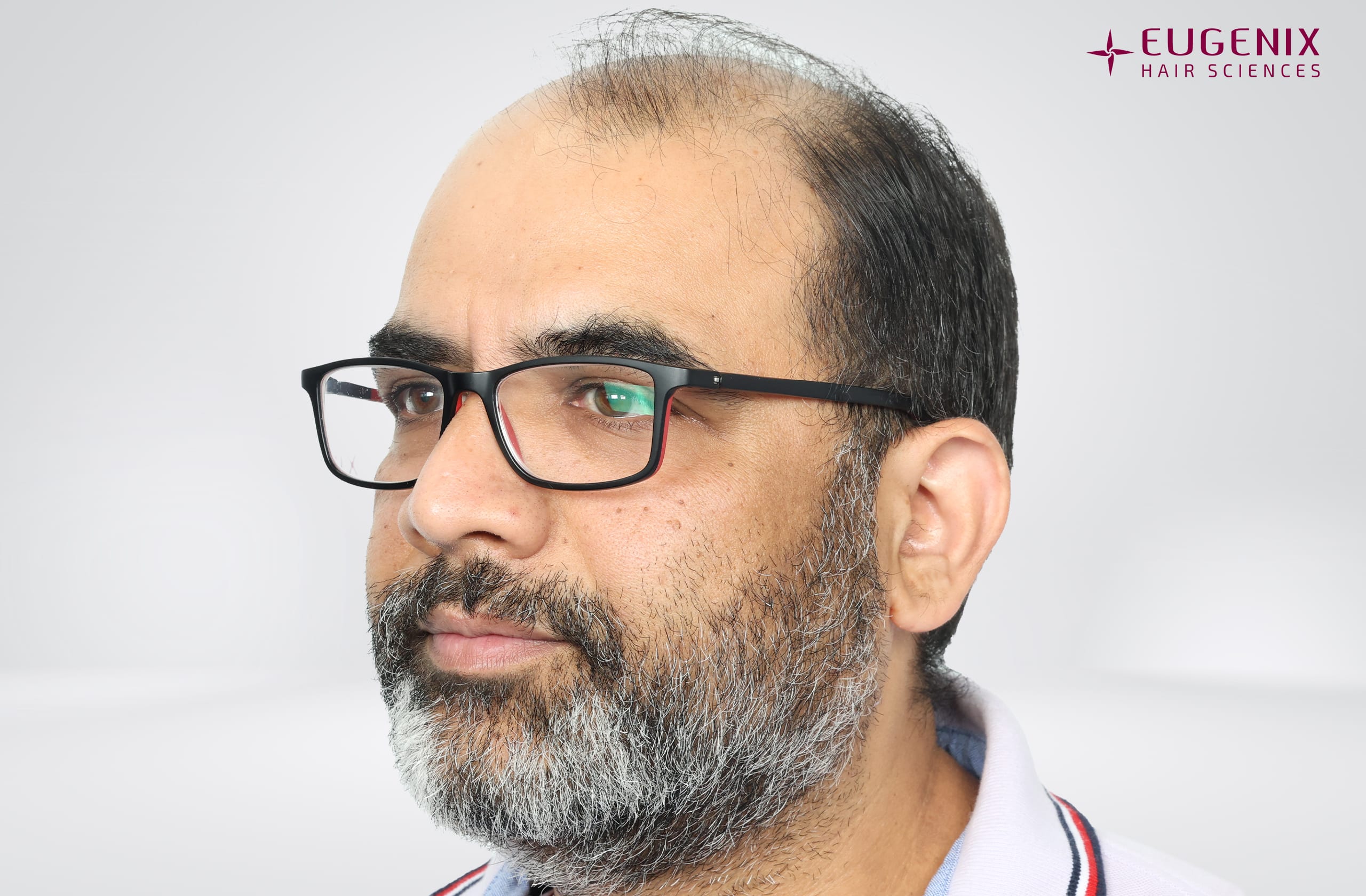 Vamshi Velma Before Right copy