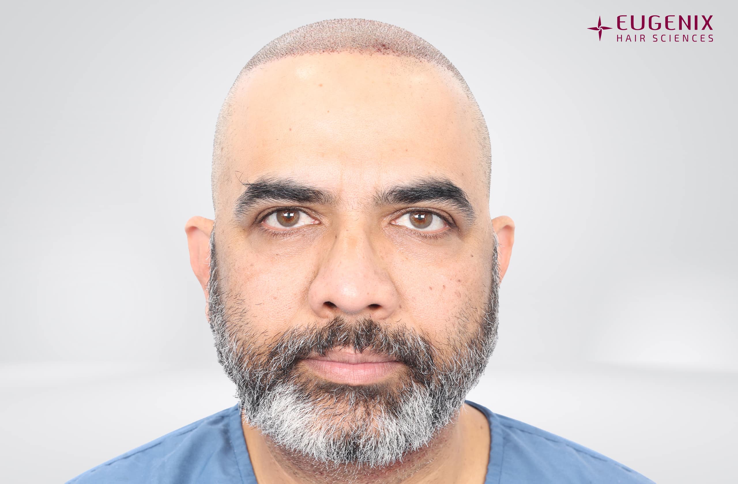 Vamshi Velma Post-op Front copy