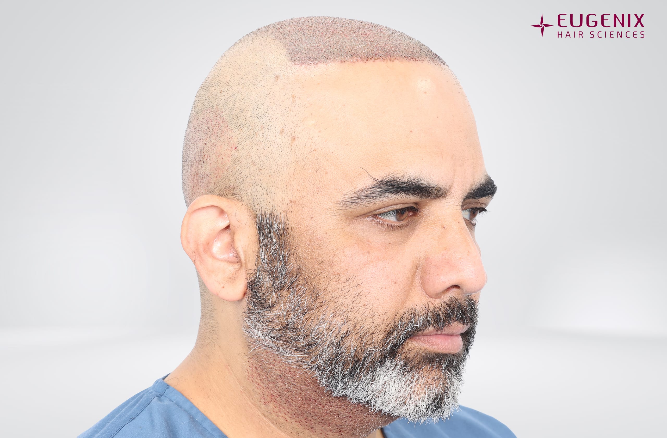 Vamshi Velma Post-op Left copy