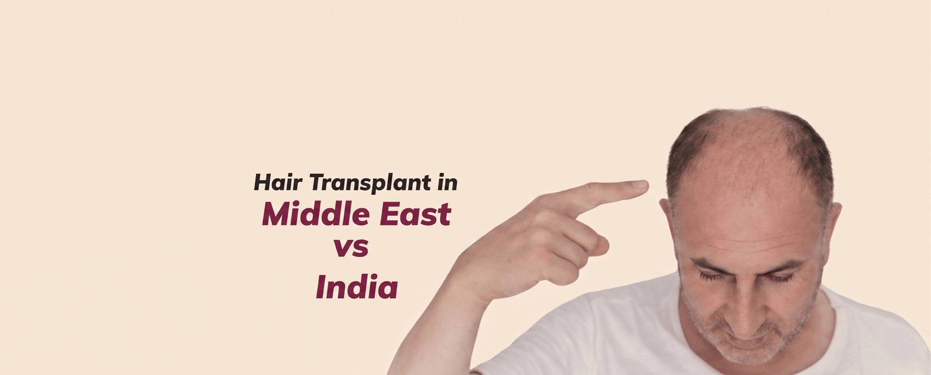 Hair Transplant in Middle East vs India: Cost, Quality and What Middle Eastern Patients Need to Know