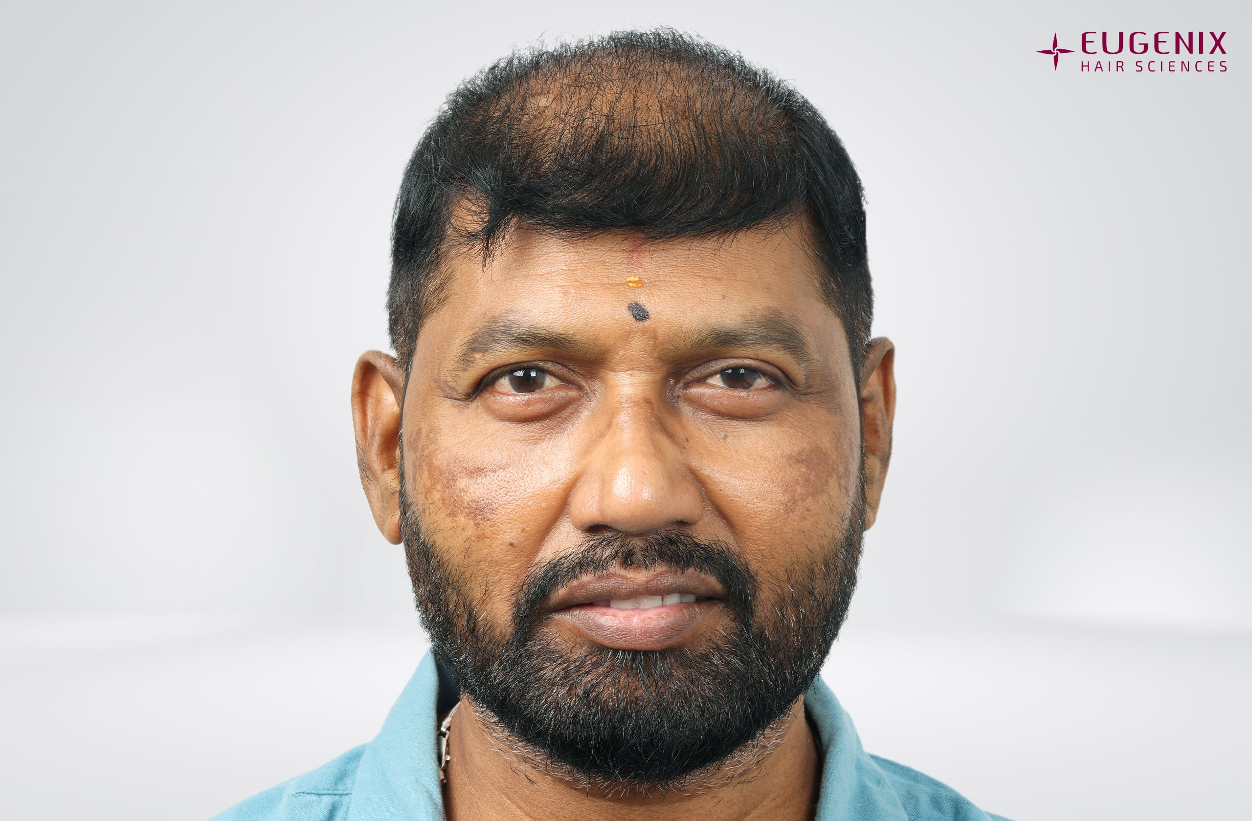 Prem Anand Front Before copy
