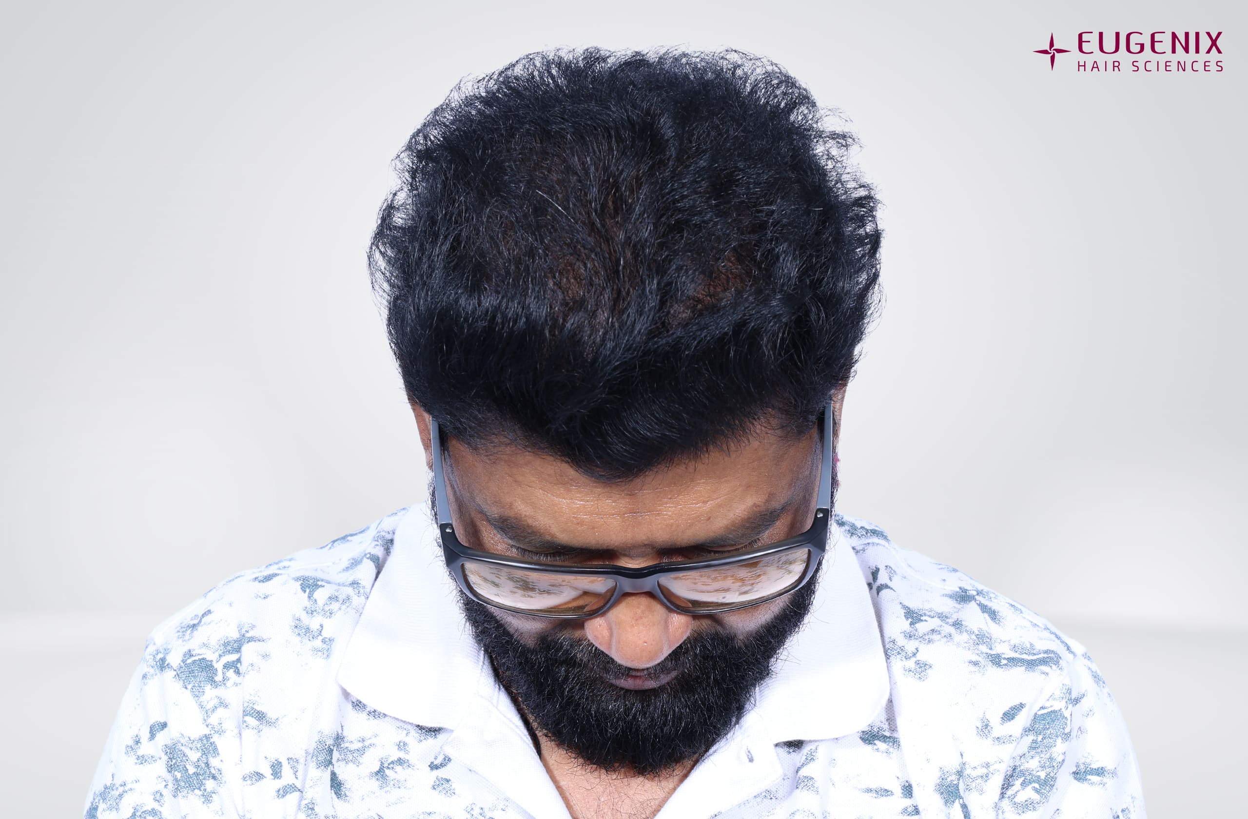 Prem Anand Head Down After copy