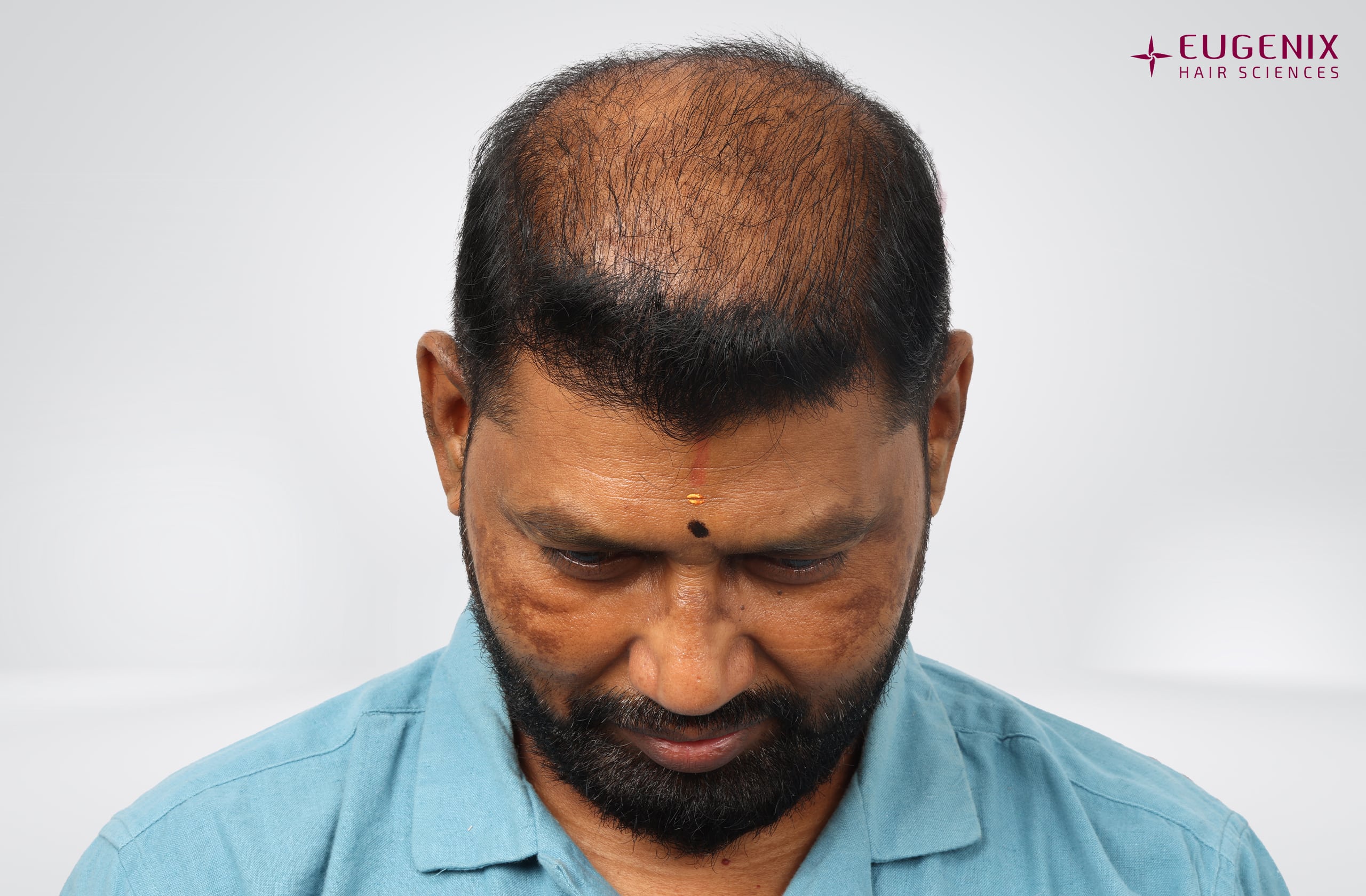 Prem Anand Head Down Before copy