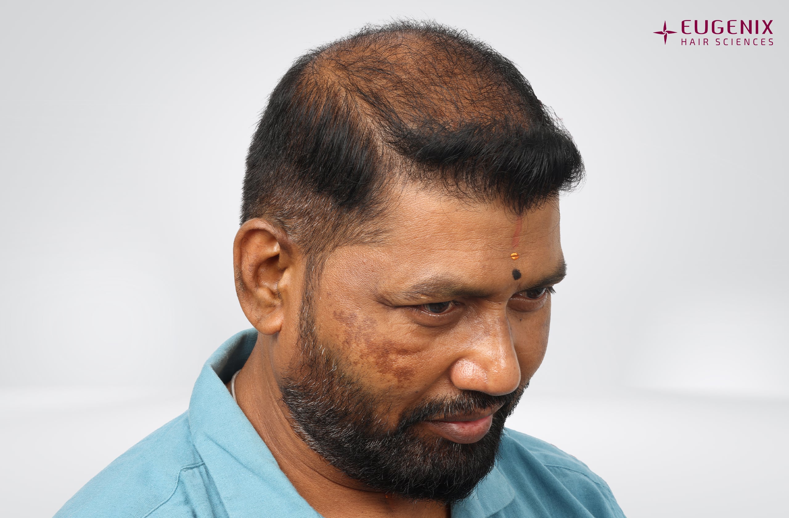 Prem Anand Left Before copy