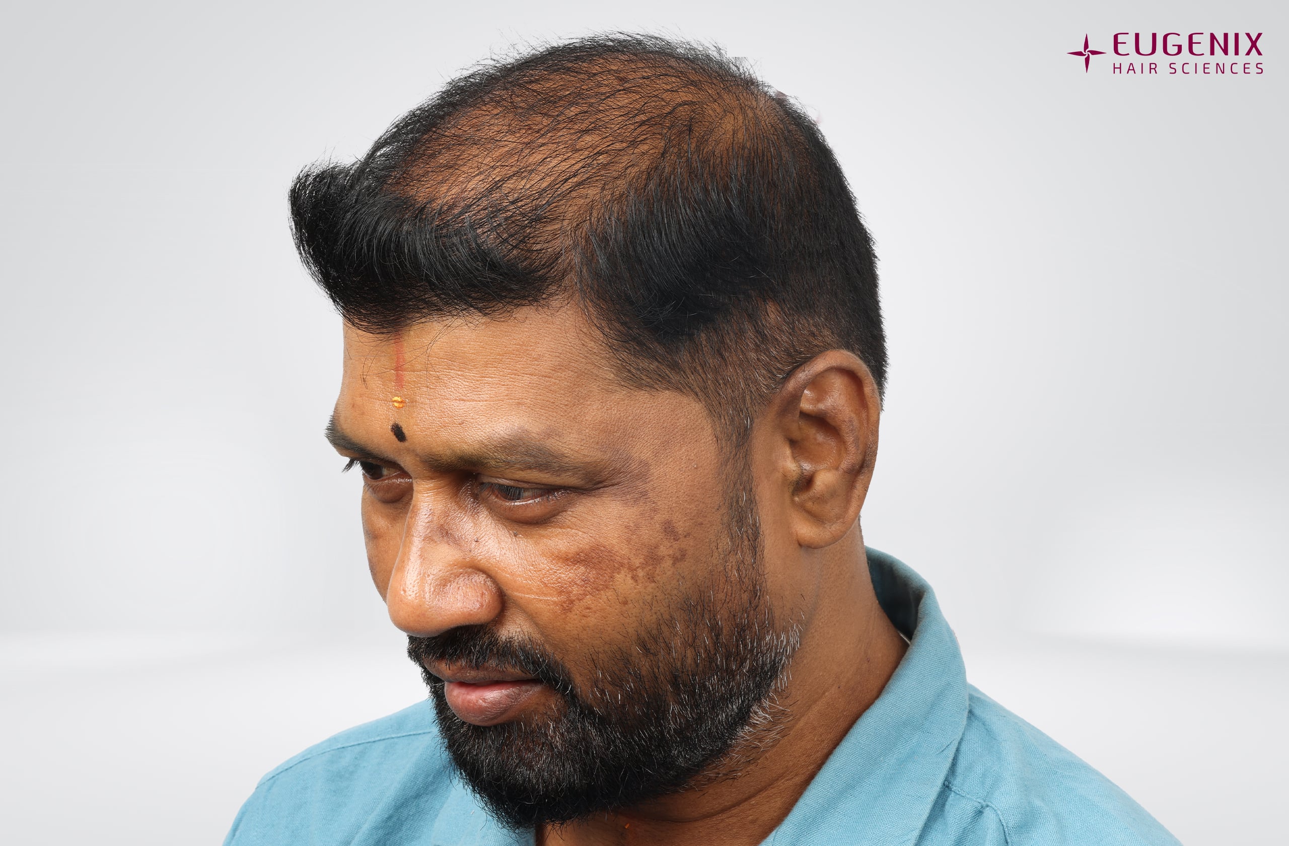 Prem Anand Right Before copy