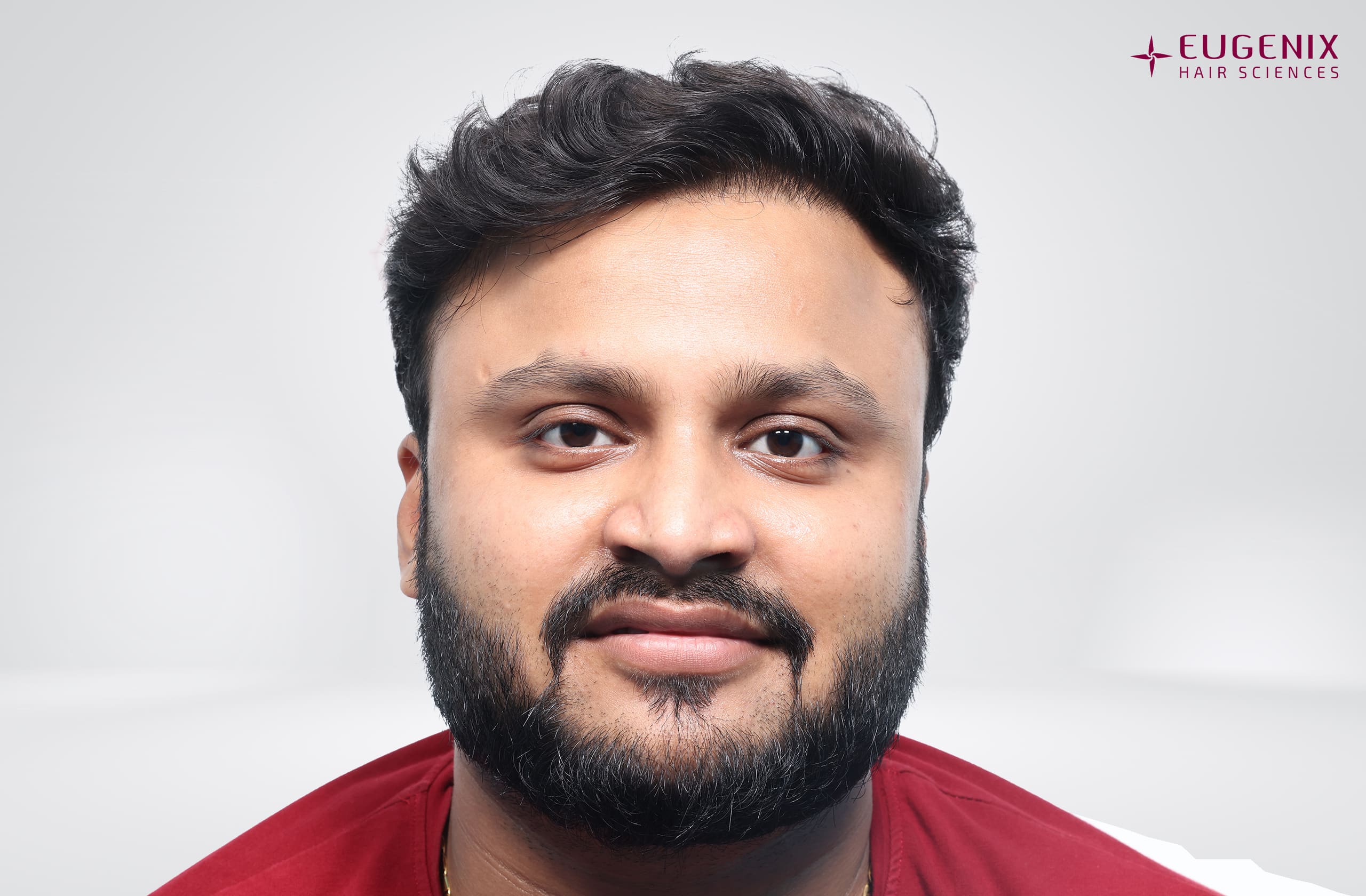 Tarun Garg Front After copy
