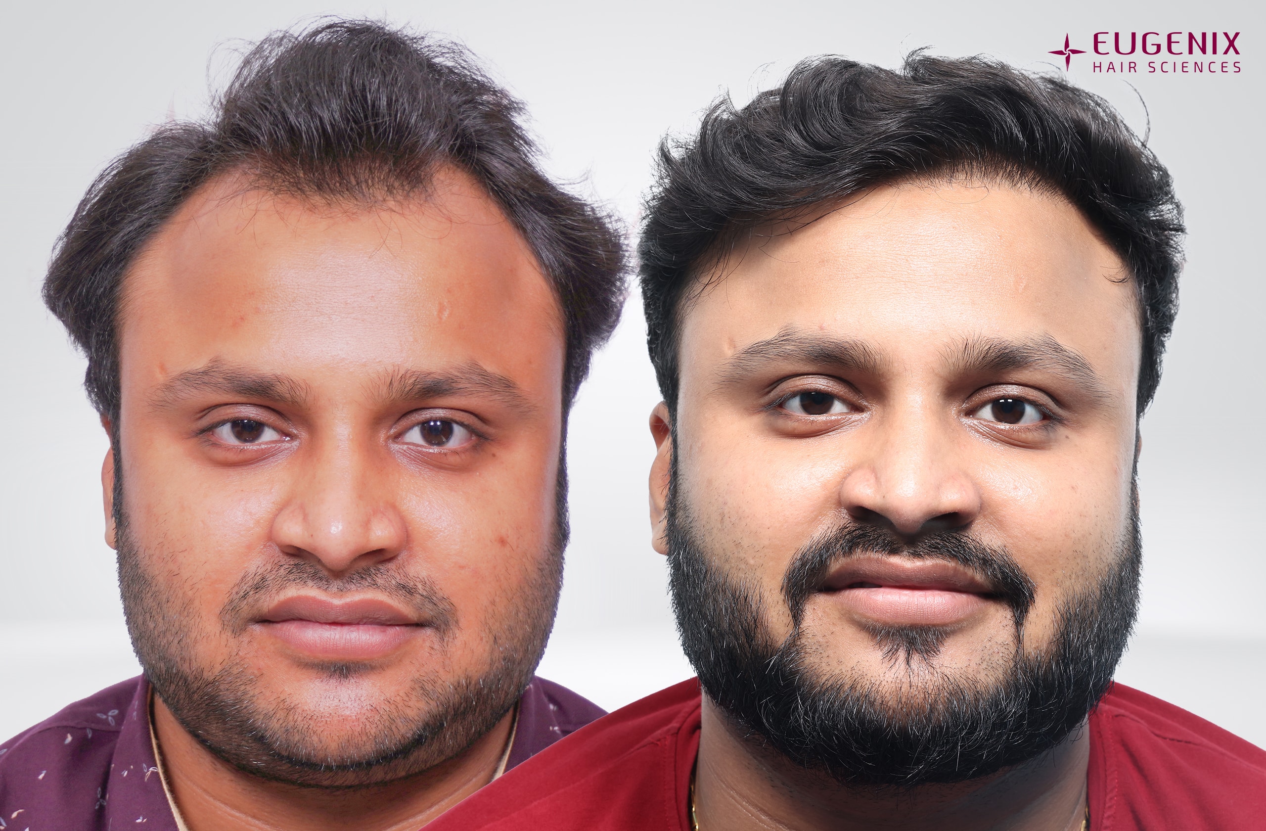 Tarun Garg Front Before & After copy