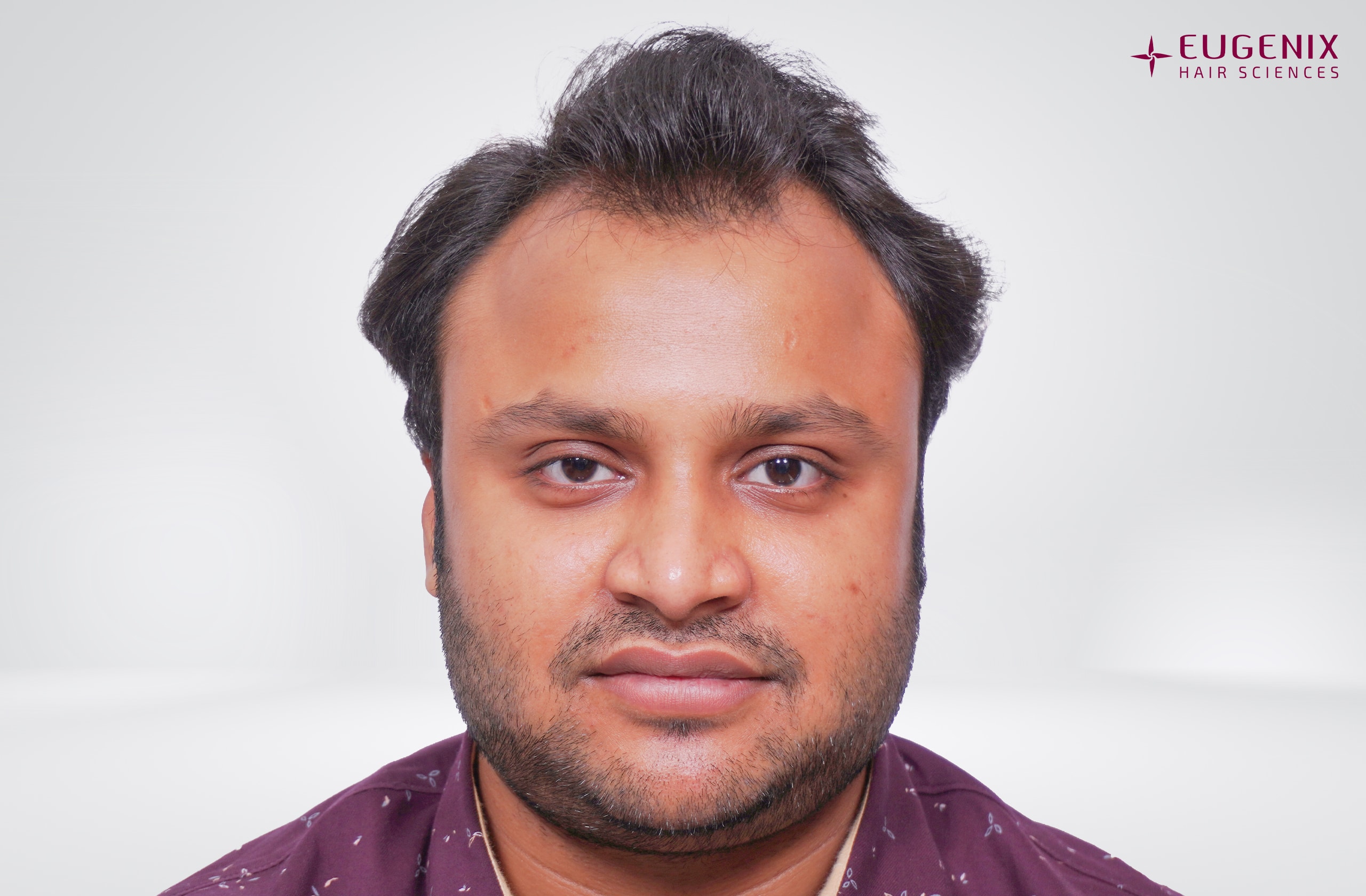 Tarun Garg Front Before copy