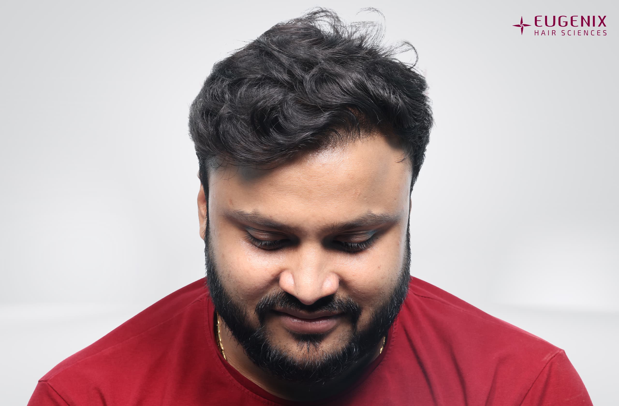 Tarun Garg Head Down After copy