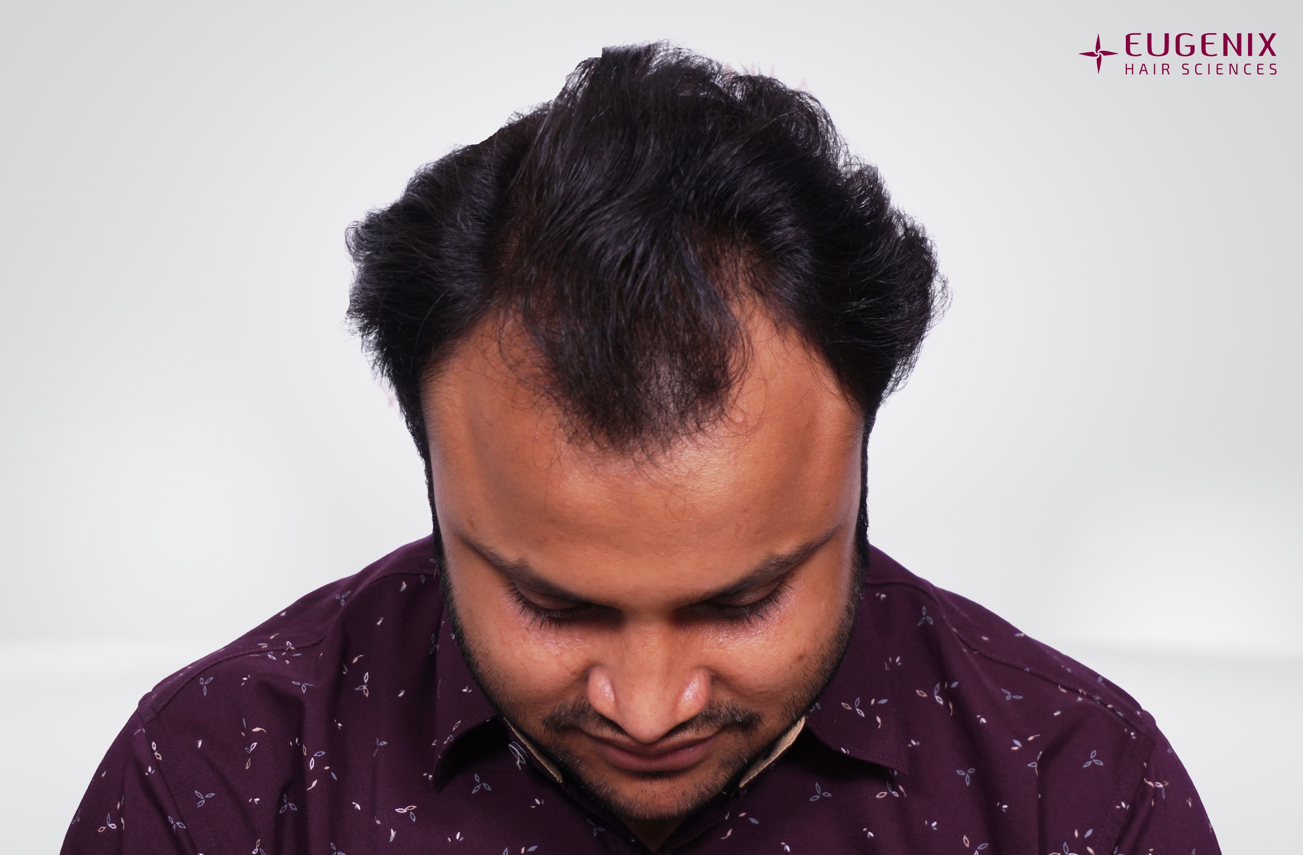 Tarun Garg Head Down Before copy
