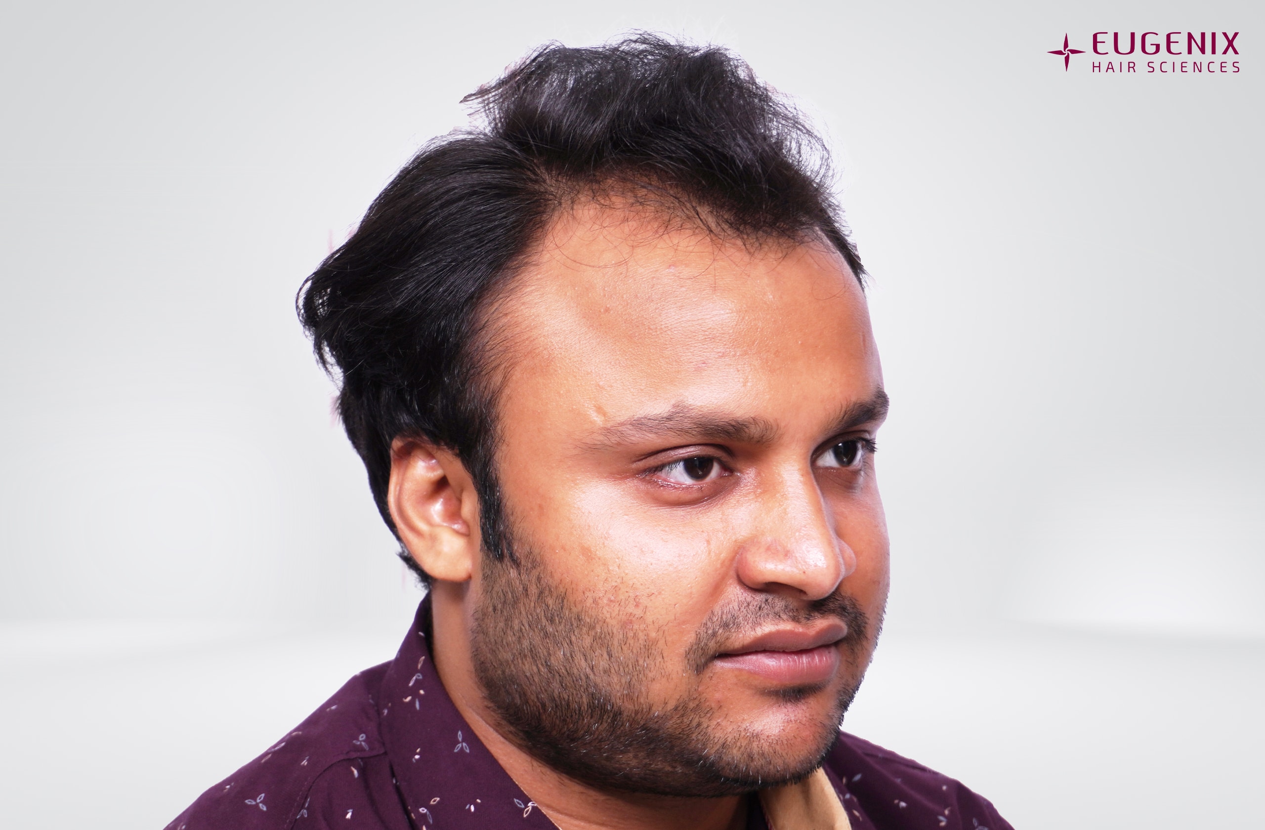 Tarun Garg Left Before copy