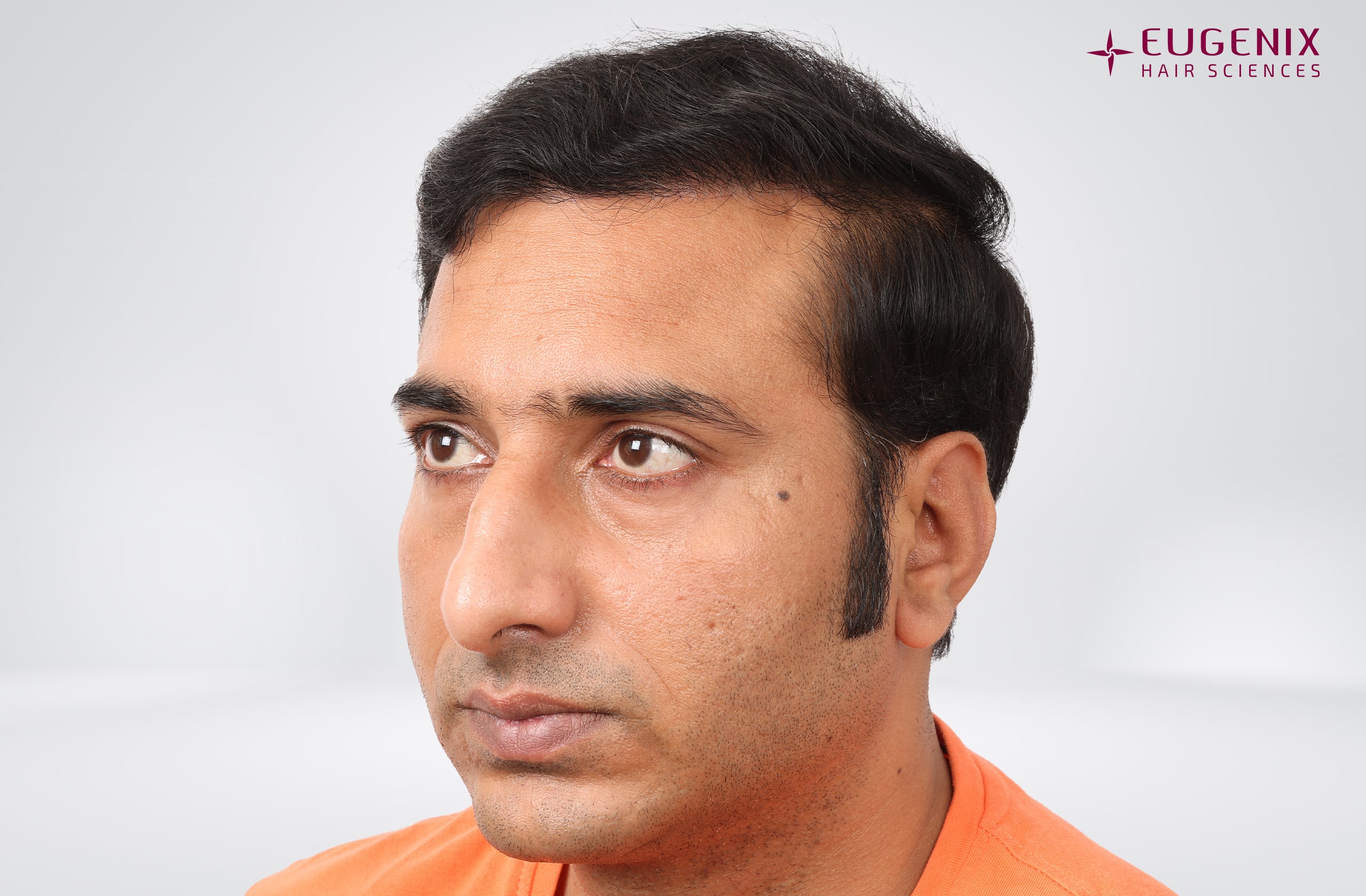 Avinash After Right copy