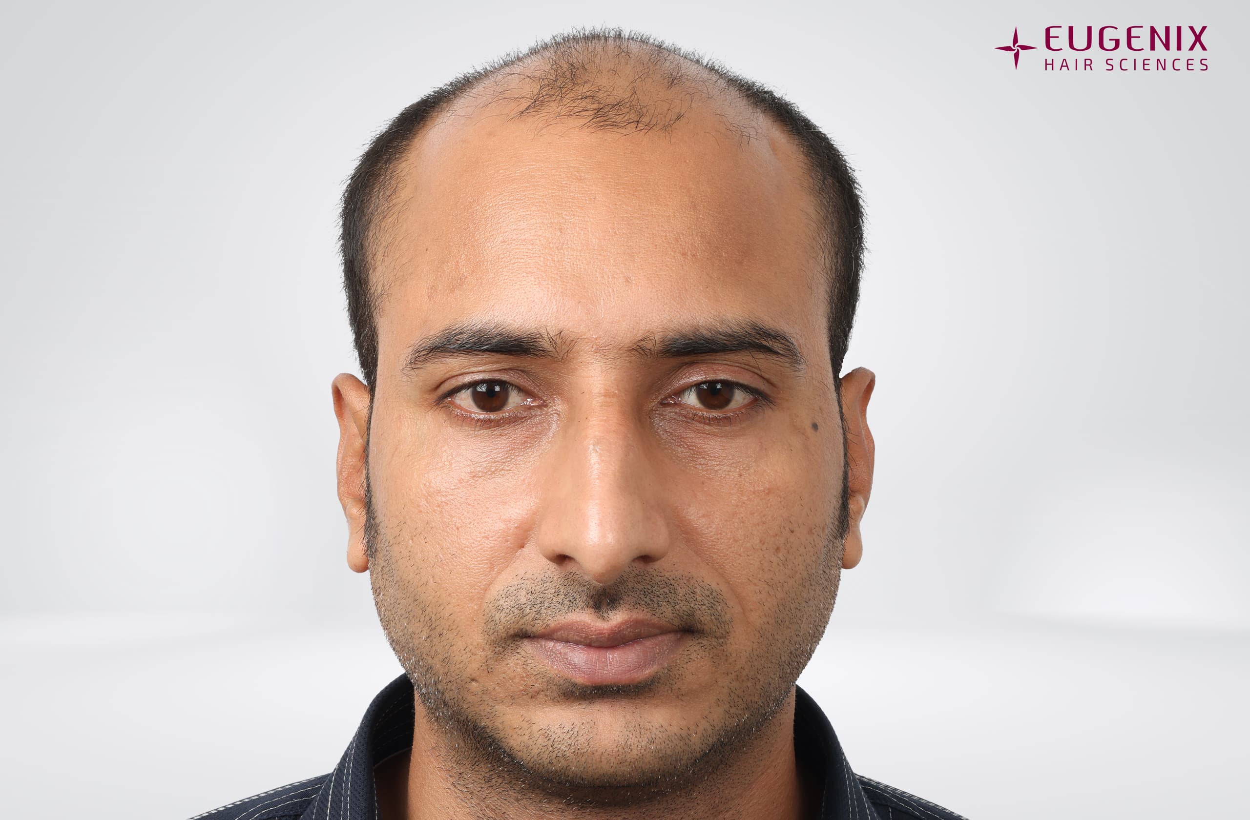 Avinash Before Front copy