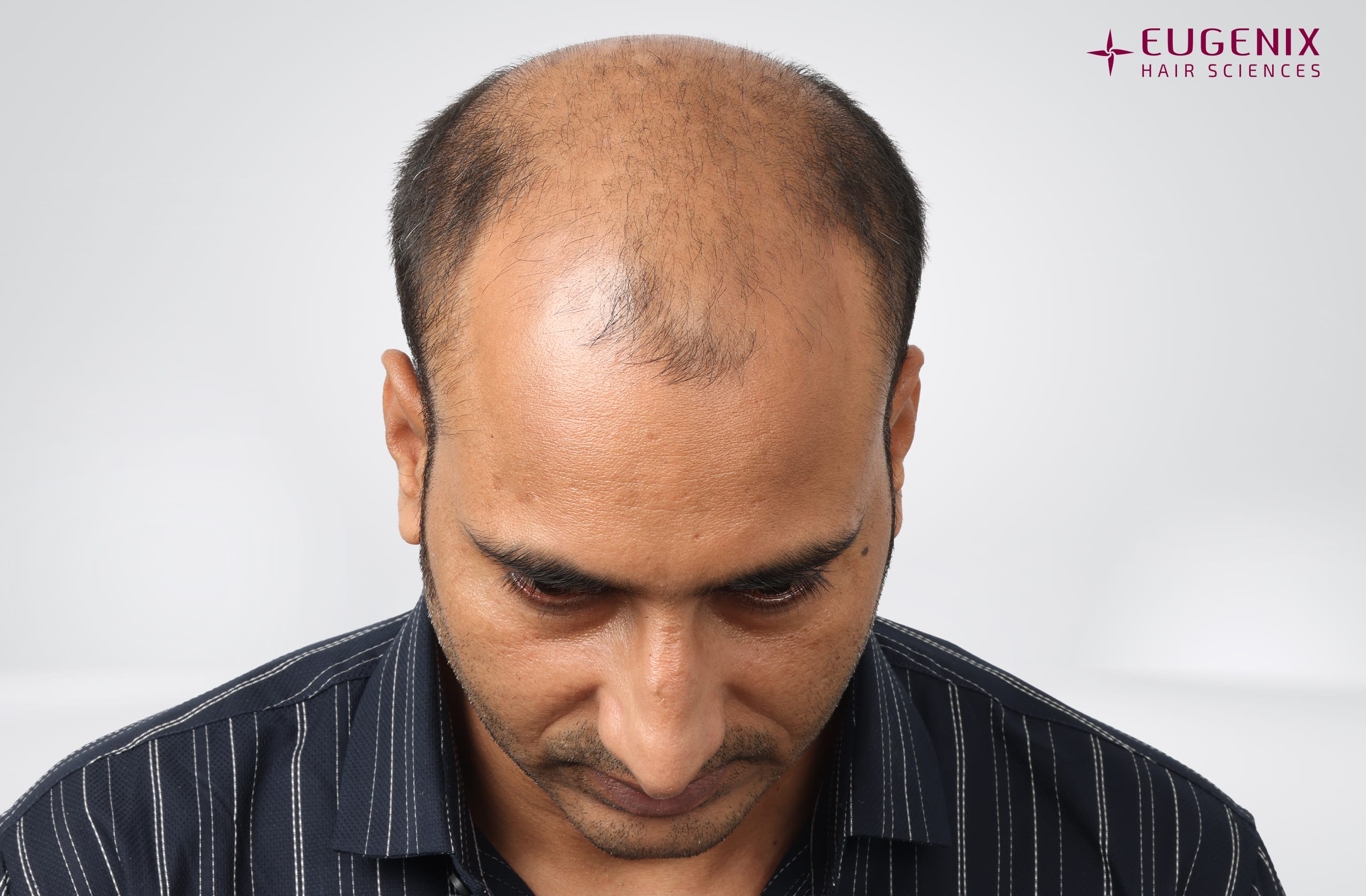Avinash Before Head Down copy