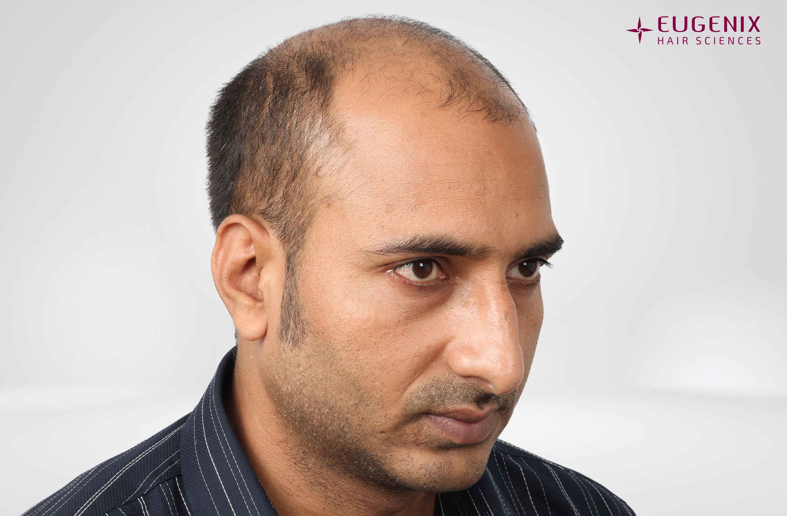 Avinash Before Left copy