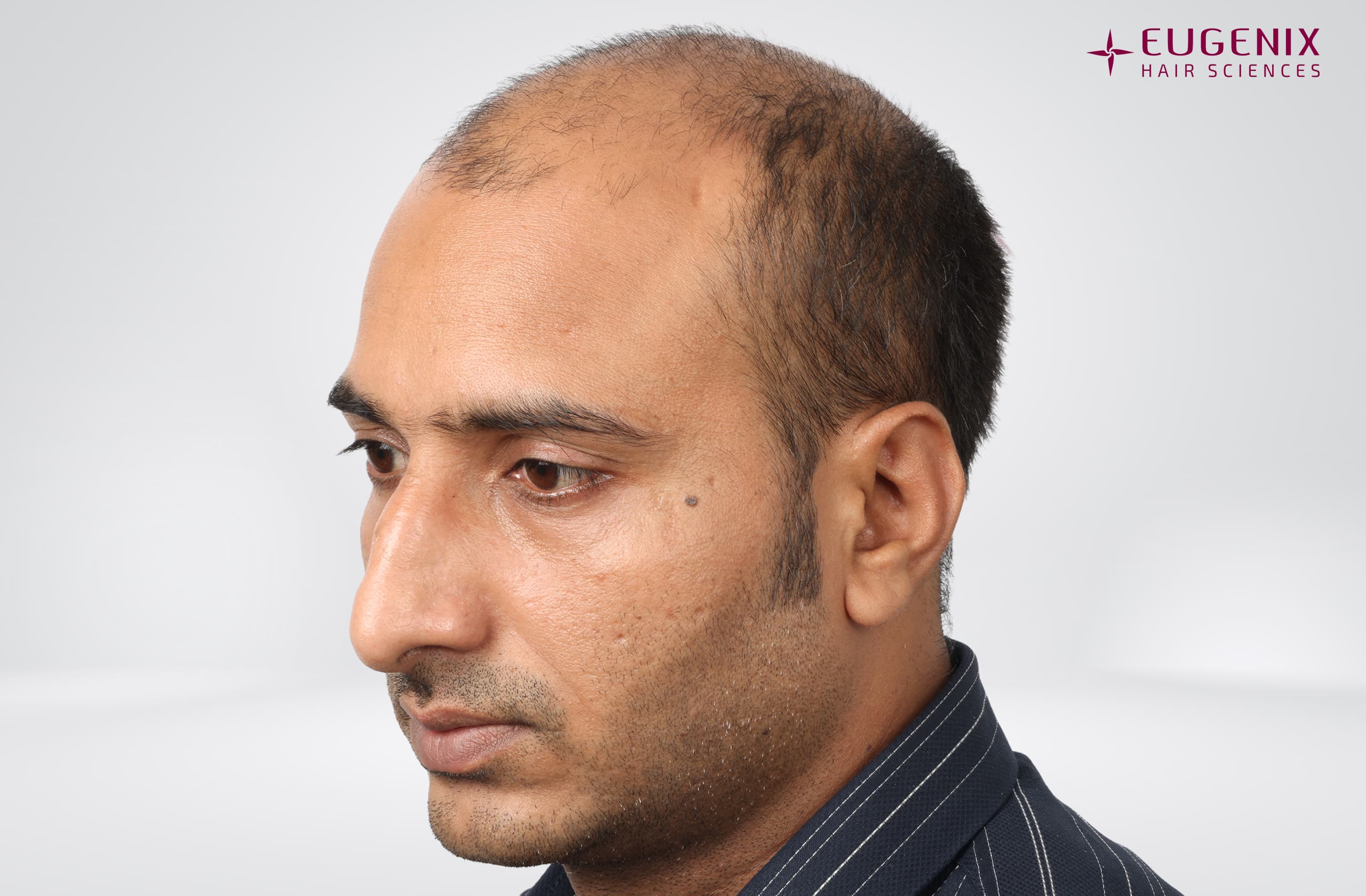 Avinash Before Right copy
