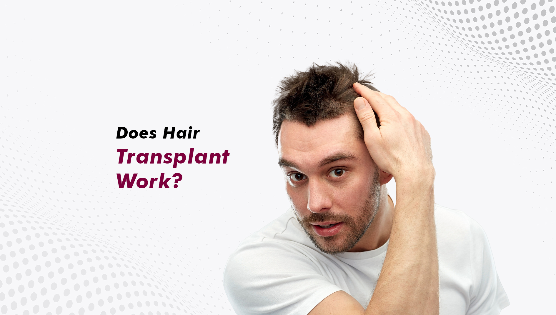 Do Hair Transplants Work? Science, Results, and What to Realistically Expect