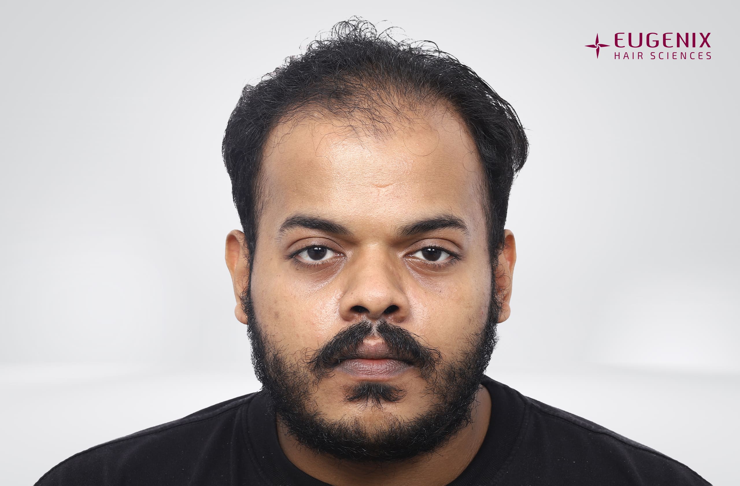 Harivishnu D Before Front copy