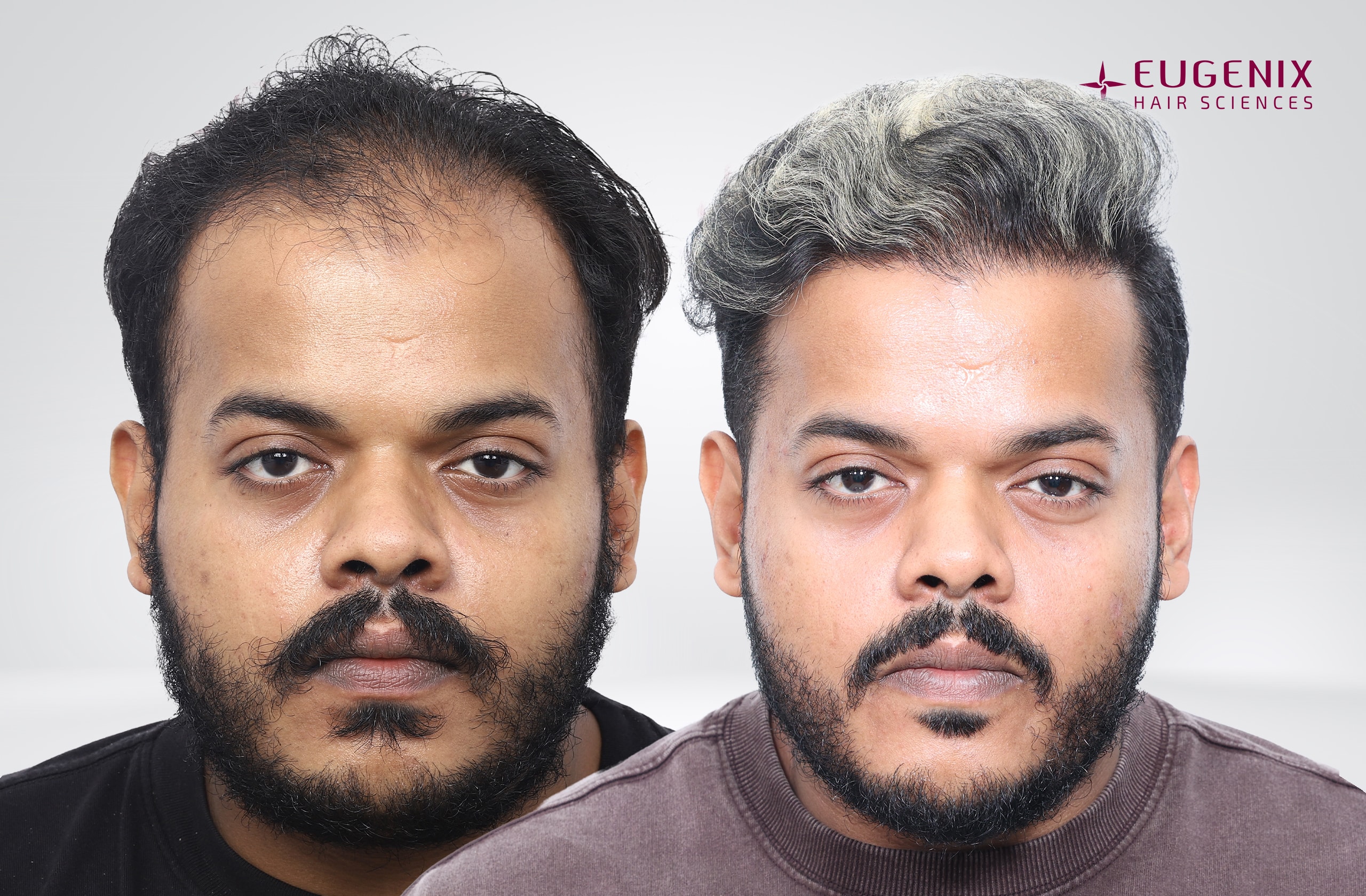 Harivishnu D Before and After Front copy