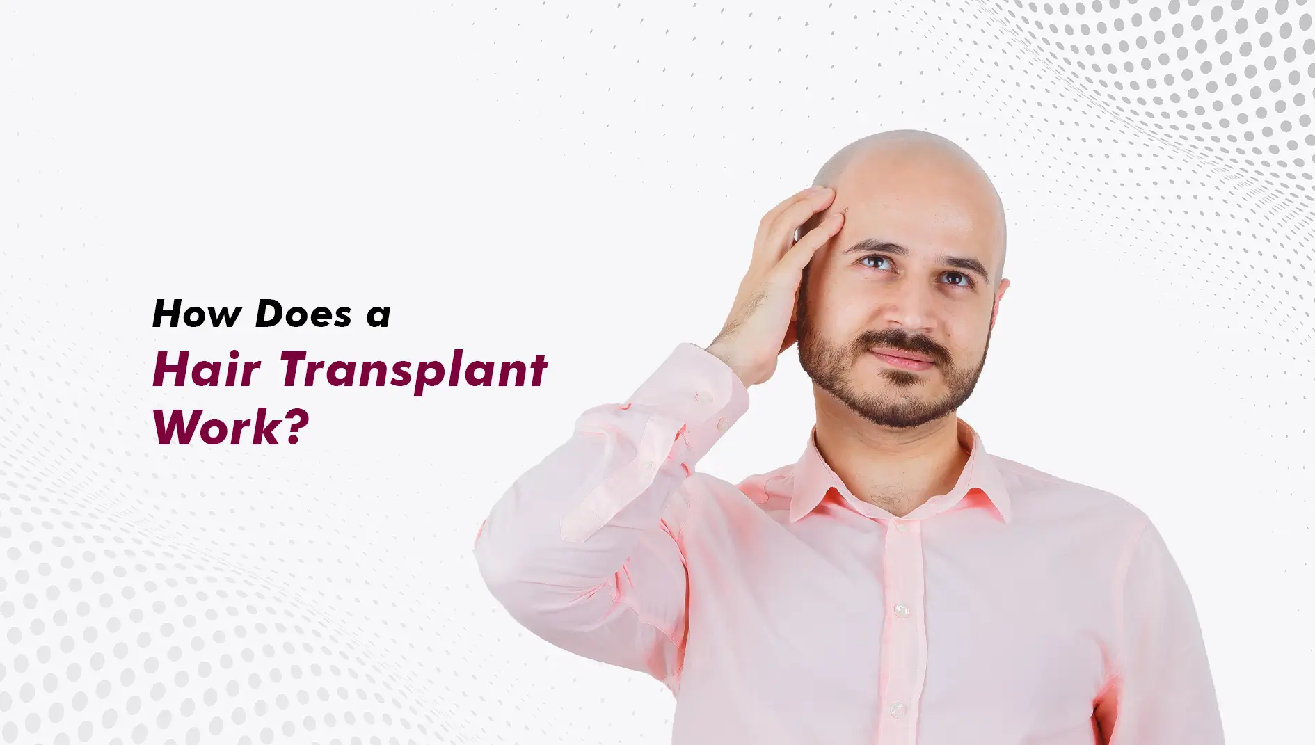 How Does a Hair Transplant Work? The Science, the Process, and What to Expect
