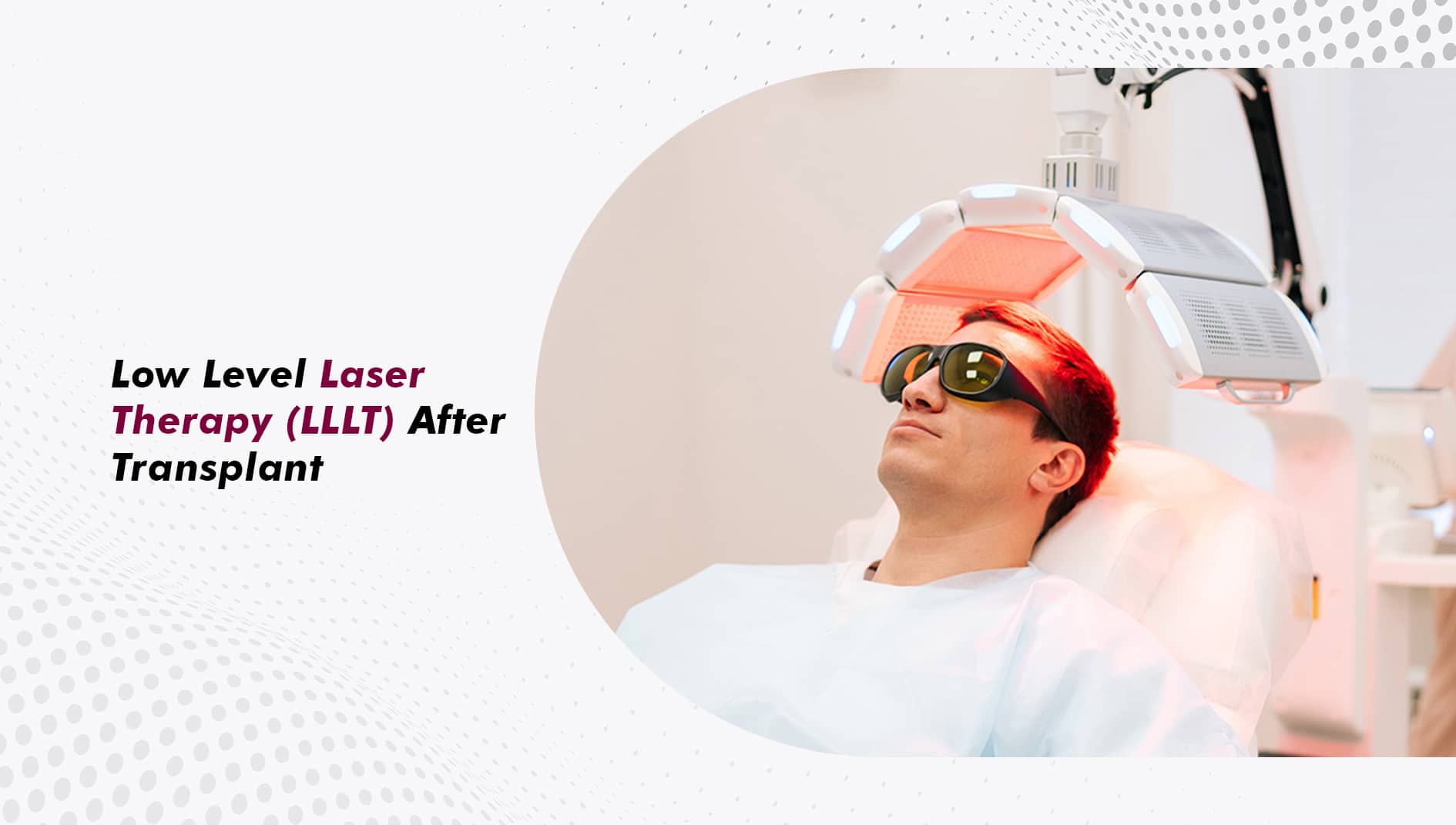 Low Level Laser Therapy (LLLT) After Transplant: A Complete Guide for Hair Transplant Patients