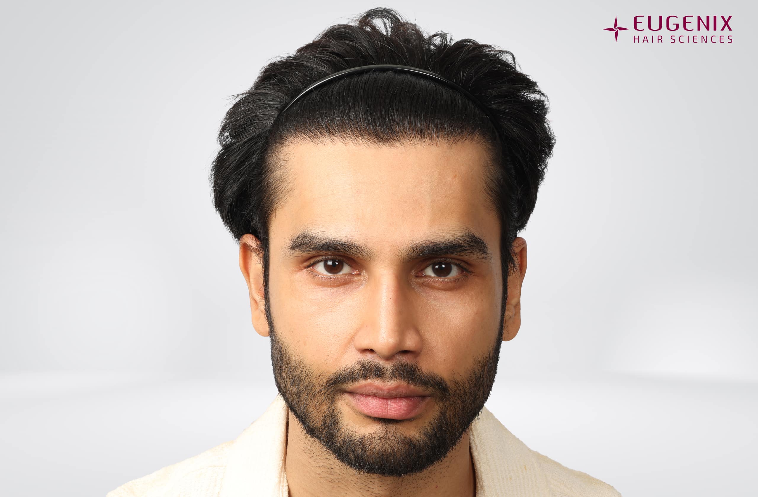 Rohit Khandelwal After Front copy
