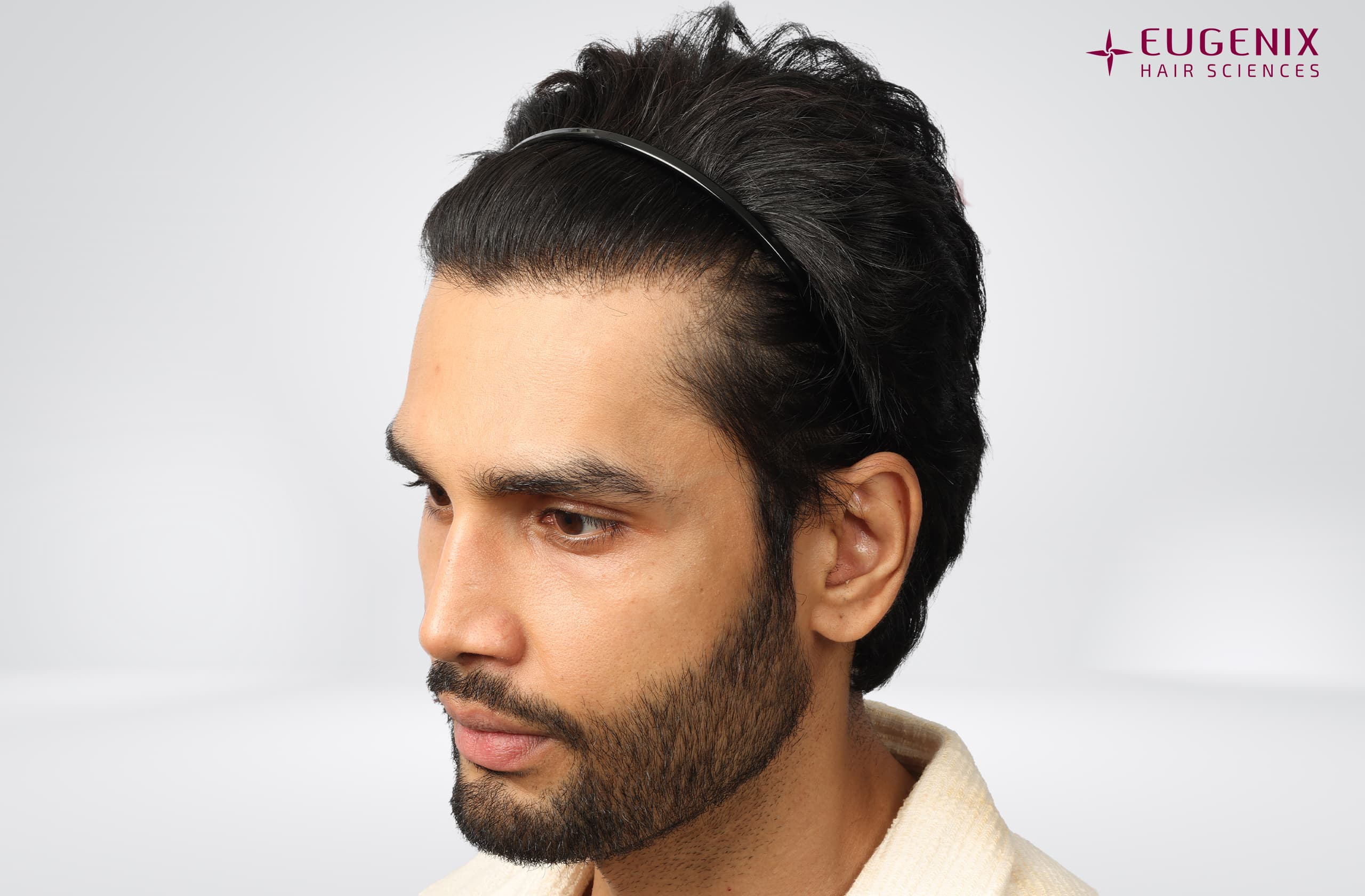 Rohit Khandelwal After Right copy
