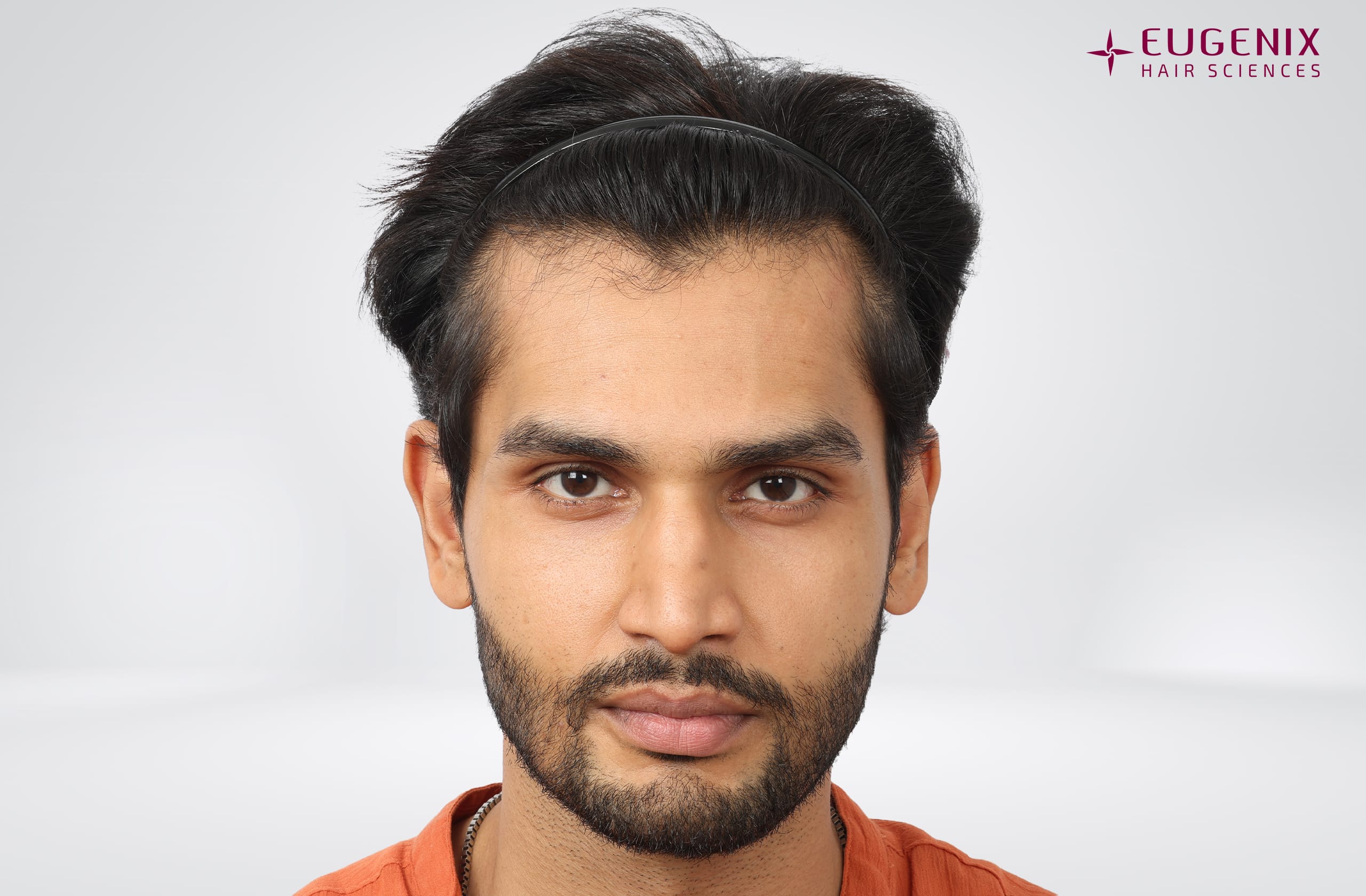 Rohit Khandelwal Before Front copy