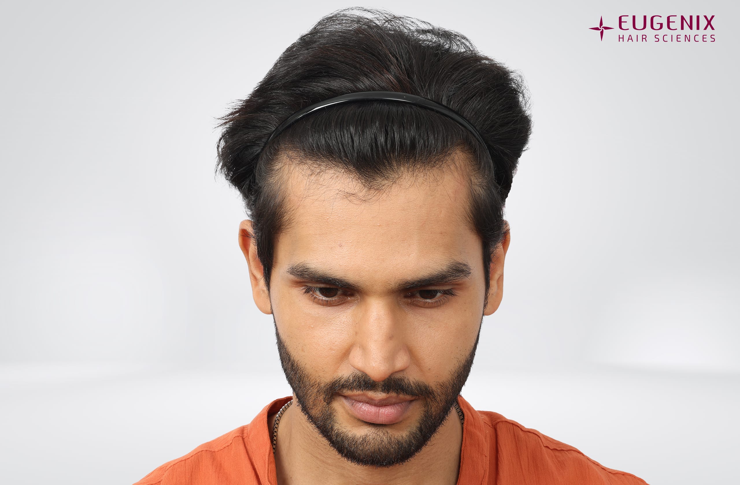 Rohit Khandelwal Before Head Down copy